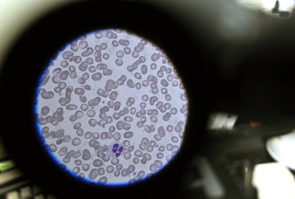 Blood cells are examined through a microscope at the Craig Joint Theater Hospital on Bagram Airfield, Afghanistan, Jan. 24, 2013. The 455th Expeditionary Medical Support Squadron laboratory technicians constantly monitor the stocked blood through quality control measures to ensure safety and proper distribution to the hospital patients. (U.S. Air Force photo/Senior Airman Chris Willis)