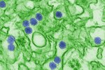This is a digitally-colorized transmission electron micrograph of Zika virus, which is a member of the family Flaviviridae. Centers for Disease Control and Prevention photo by Cynthia Goldsmith