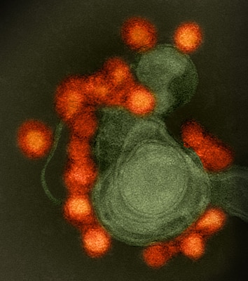 A transmission electron microscope image shows a negative-stained, Fortaleza-strain Zika virus (red), isolated from a microcephaly case in Brazil. The Walter Reed Army Institute of Research is developing a vaccine against the Zika virus in coordination with federal partners, including the Biomedical Advanced Research and Development Authority of the Department of Health and Human Services and the National Institutes of Health National Institute of Allergy and Infectious Diseases. National Institutes of Health photo
