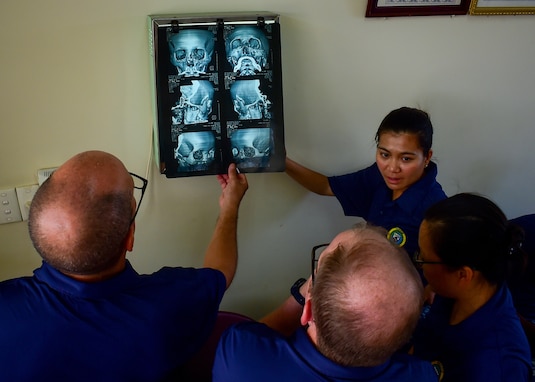 Navy medical professionals inspect a surgical candidate's three-dimensional reconstruction scan during Pacific Partnership 2018.