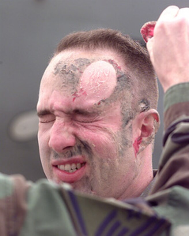 U.S. Air Force Staff Sgt. Gary Cleland winces in pain as mulage, simulating head injuries, is removed from his face after a joint Major Accident Response Exercise at Grand Forks, N.D., on Oct. 15, 1998. Cleland played the role of plane crash victim during the exercise conducted at the Grand Forks International Airport with the airport firefighters and military personnel from Grand Forks Air Force Base. The scenario involved a response to the crash of a KC-135 Stratotanker. Cleland is attached to the 319th Air Refueling Wing, Social Actions Office, Grand Forks Air Force Base, N.D. 