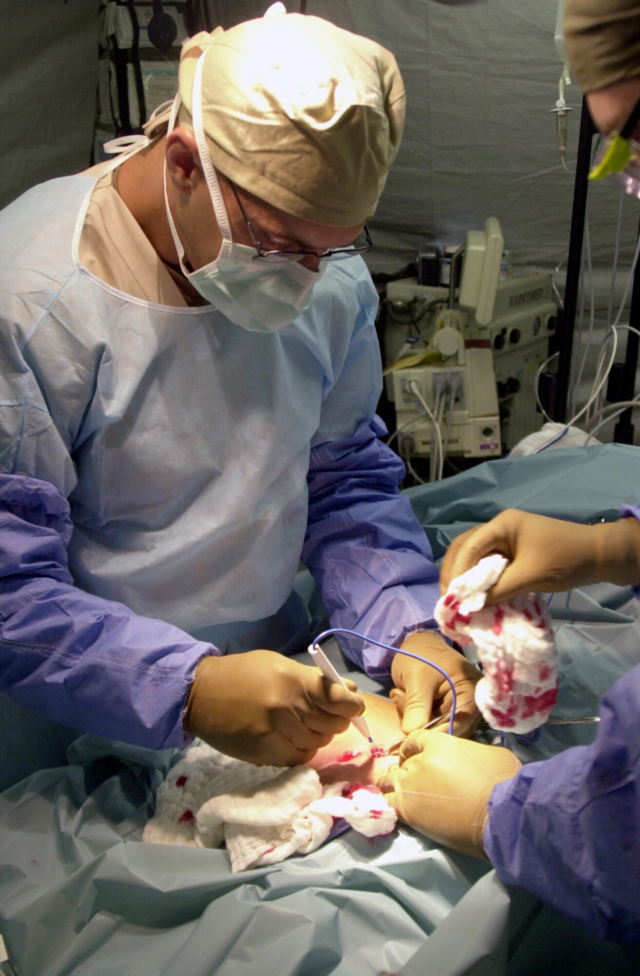 ANDERSEN AIR FORCE BASE, Guam -- Maj. (Dr.) David Copp cauterizes some tissue surrounding a patient's cyst during surgery in an expeditionary medical support tent.  Copp is a general surgeon with the 7th Expeditionary Medical Squadron and deployed here from Elmendorf Air Force Base, Alaska.  (Courtesy photo)