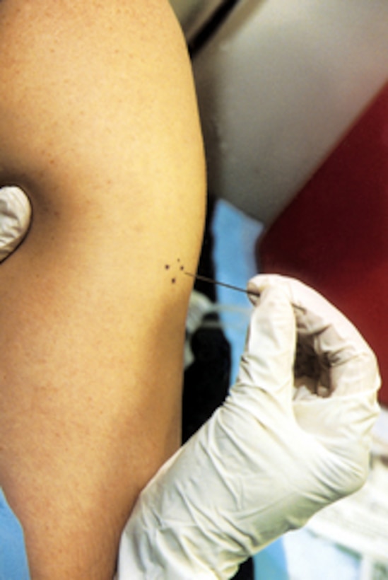 Air Force Master Sgt. Ray Anspach immunizes a soldier against smallpox at Walter Reed Army Medical Center on Jan. 14, 2003. Anspach is using a bifurcated or forked needle to administer the vaccine. 