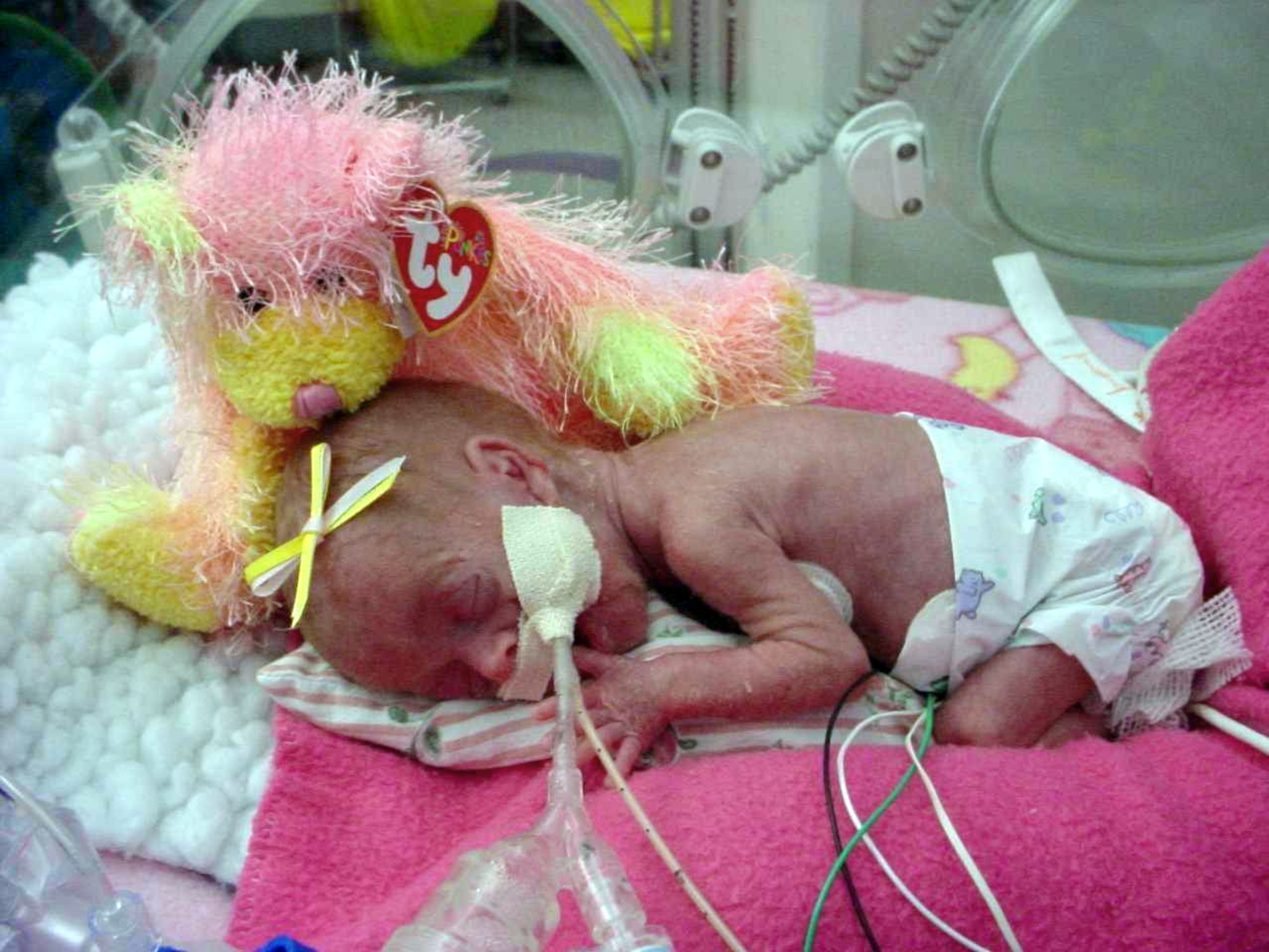 SALT LAKE CITY -- Grace Davenport, 2 weeks old, sleeps during an extended stay in a hospital neonatal intensive care unit here.  Grace was born four months premature, along with a twin brother who died two days after birth.  Her mother, Stacy Davenport, received donated leave during this time through the Federal Voluntary Leave Transfer Program.  Mrs. Davenport works in the maintenance directorate at Hill Air Force Base, Utah.  (Courtesy photo)