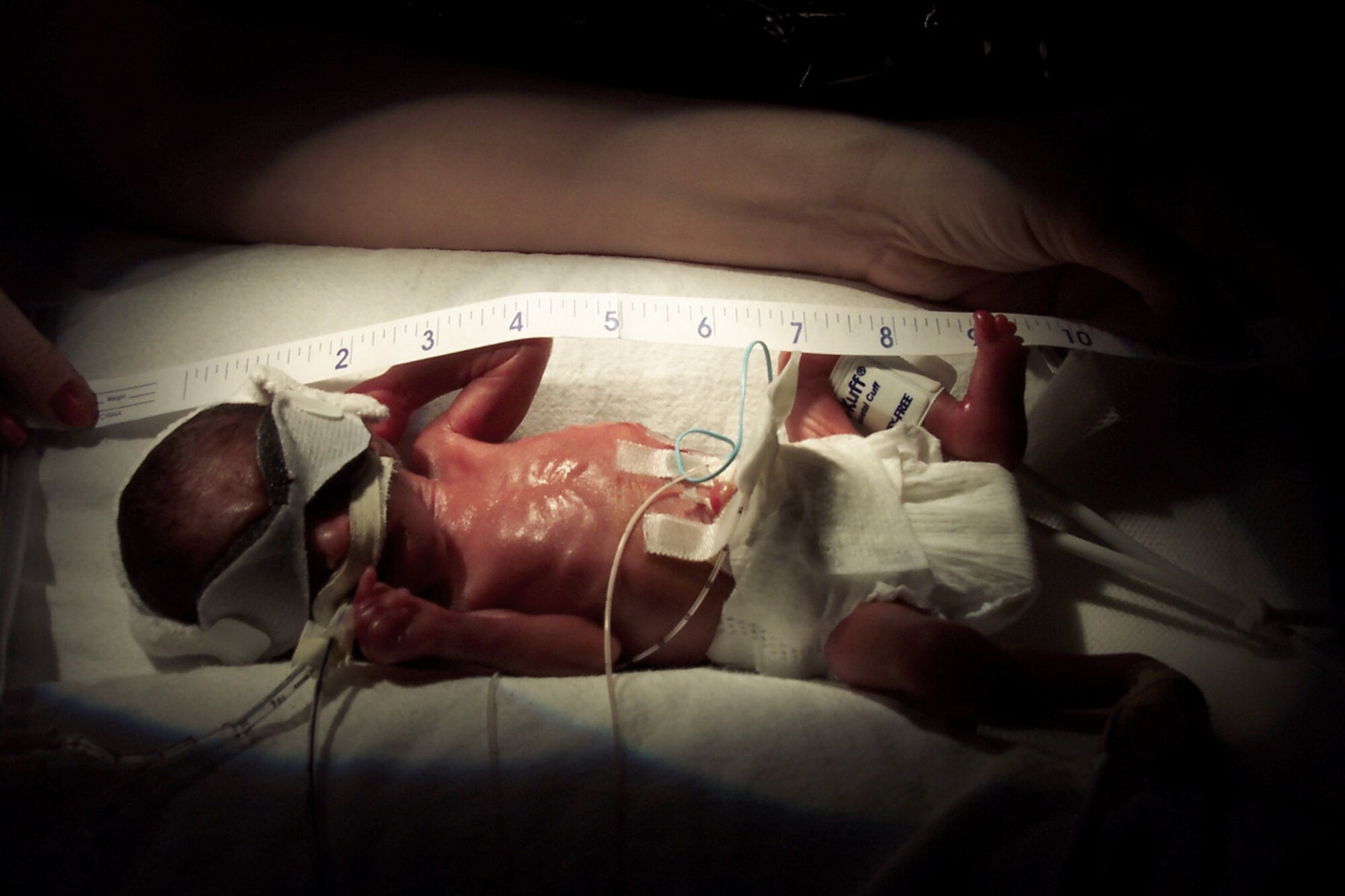 CAMDEN, N.J. -- Ariam Marie Morales is measured at a hospital here, where she was born 16 weeks early.  At birth, she measured 12 inches long.  She is the daughter of Mayra and Staff Sgt. Freddie Morales Fernandez of nearby McGuire Air Force Base.  (Courtesy photo)
