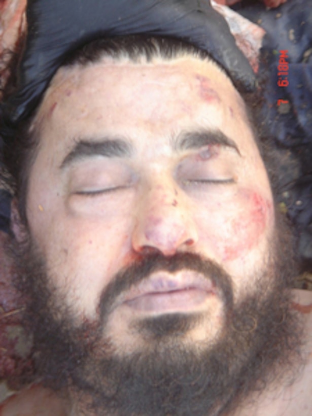 The body of Abu Musab al-Zarqawi photographed after he was killed in a coalition air strike on June 7, 2006. Department of Defense photo. 