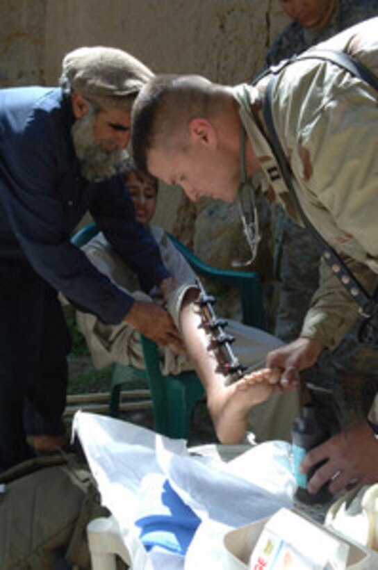 U.S. Air Force Capt. Gary Sneller (right) examines a boy's leg during a medical civic assistance program in Pech Valley, Afghanistan, on May 4, 2006. Sneller is assigned to the 1st Battalion, 32nd Infantry Regiment. 