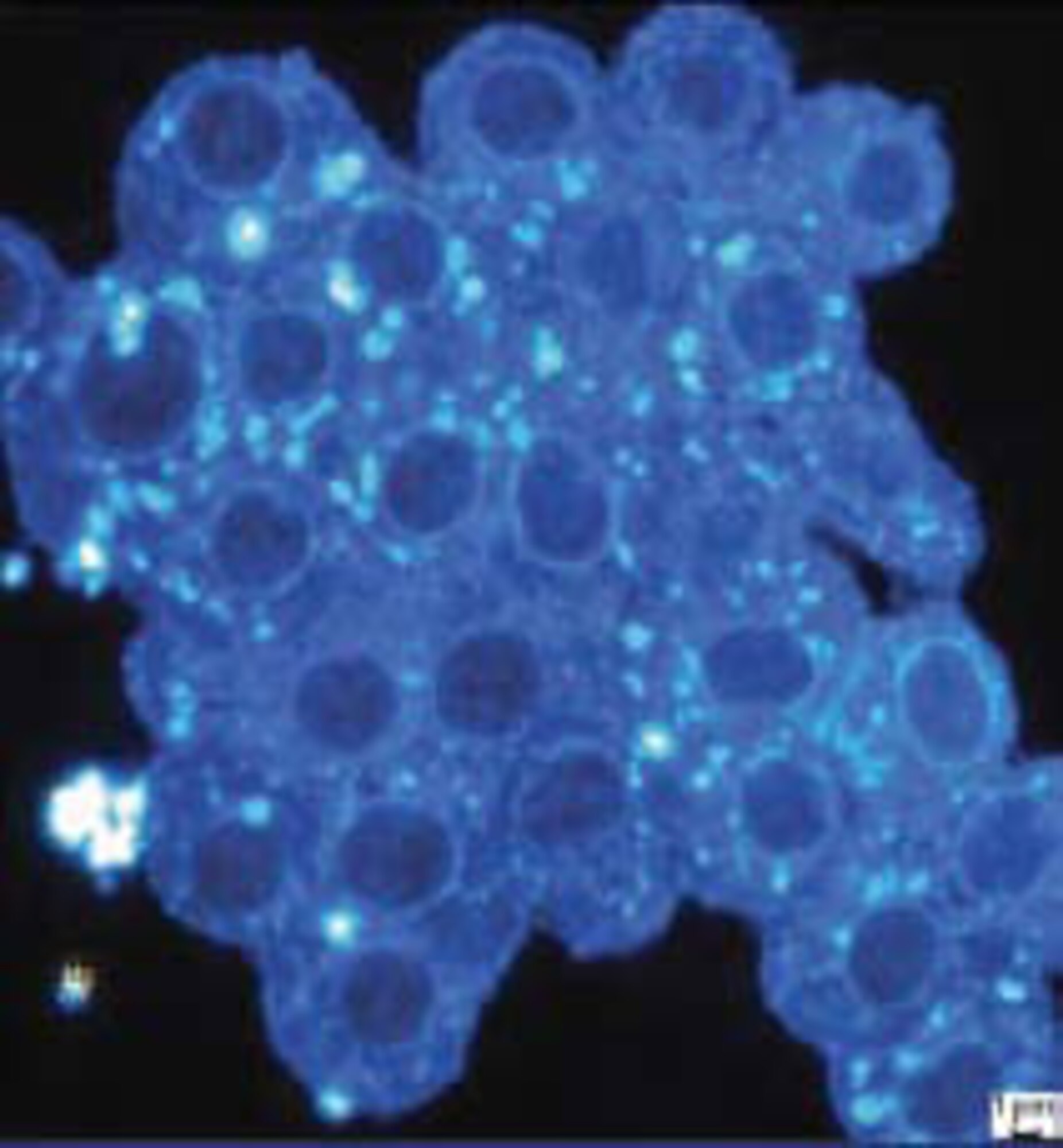 Visualization of the uptake of manganese nanoparticles in cultured PC-12 cells