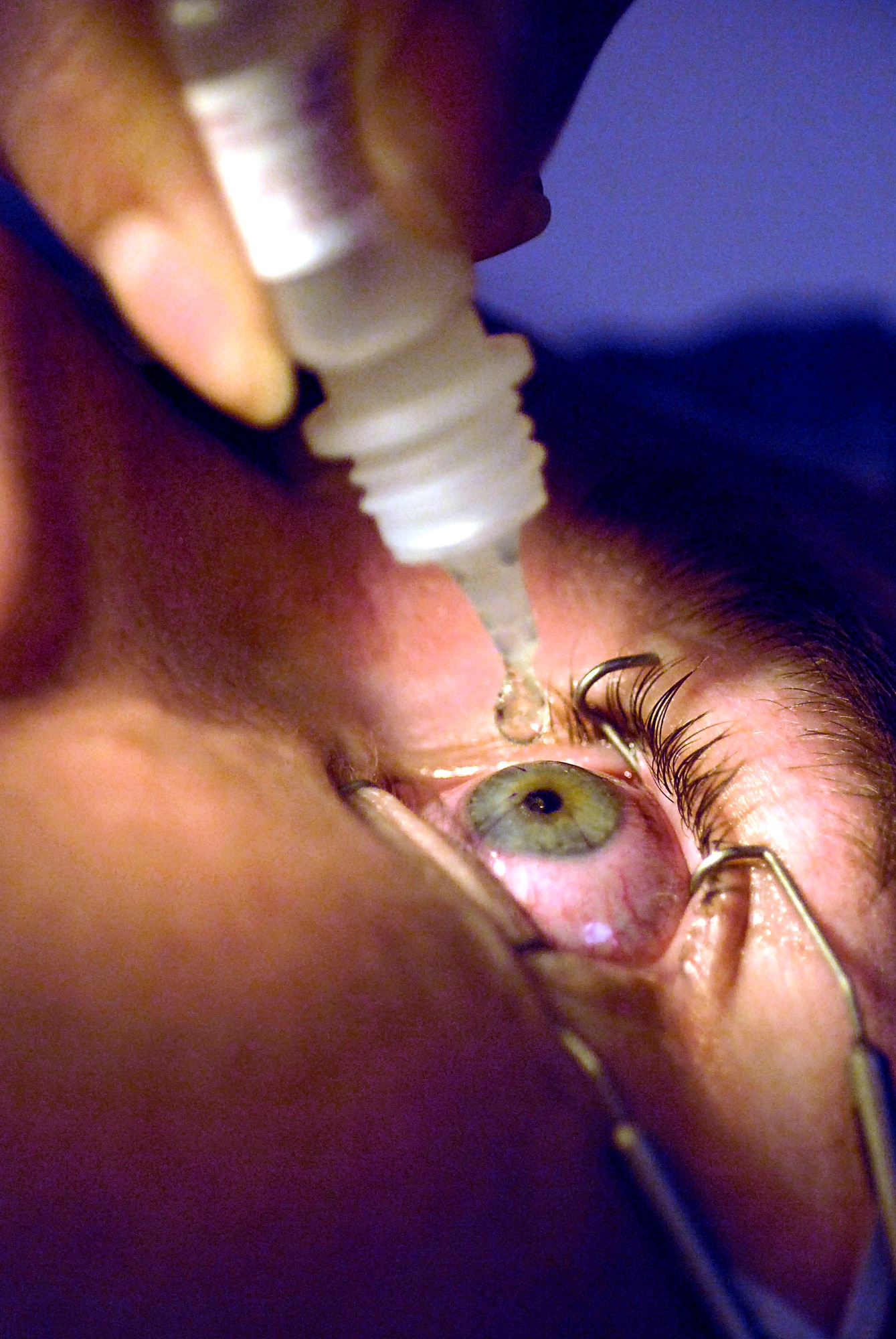 Lt. Col. Charles Reilly drops solution into Senior Airman John Paul Marsh's eye just after laser eye surgery Aug. 23 at the newly opened Defense Department Joint Warfighter Refractive Surgery Center at Lackland Air Force Base, Texas. Colonel Reilly is the chief of the Warfighter Refractive Surgery Center and Airman Marsh is with the Air Force Band of the West. (U.S. Air Force photo/Tech. Sgt. Larry A. Simmons) 