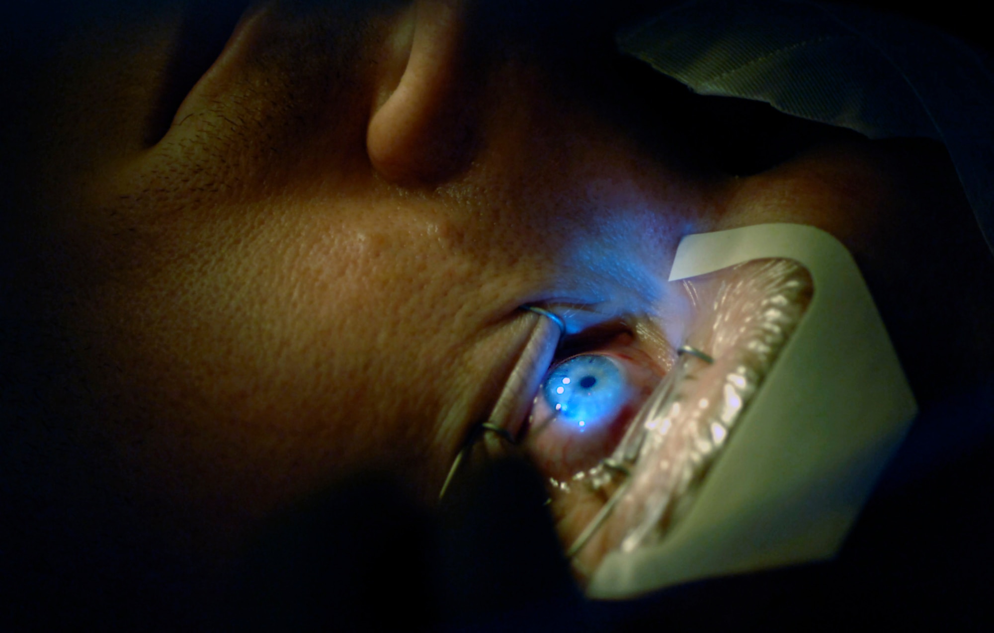 Senior Airman John Paul Marsh has his eyes checked just after receiving laser eye surgery Aug. 23 at the newly opened Defense Department Joint Warfighter Refractive Surgery at Lackland Air Force Base, Texas. Airman Marsh is with the Air Force Band of the West. (U.S. Air Force photo/Tech. Sgt. Larry A. Simmons) 
