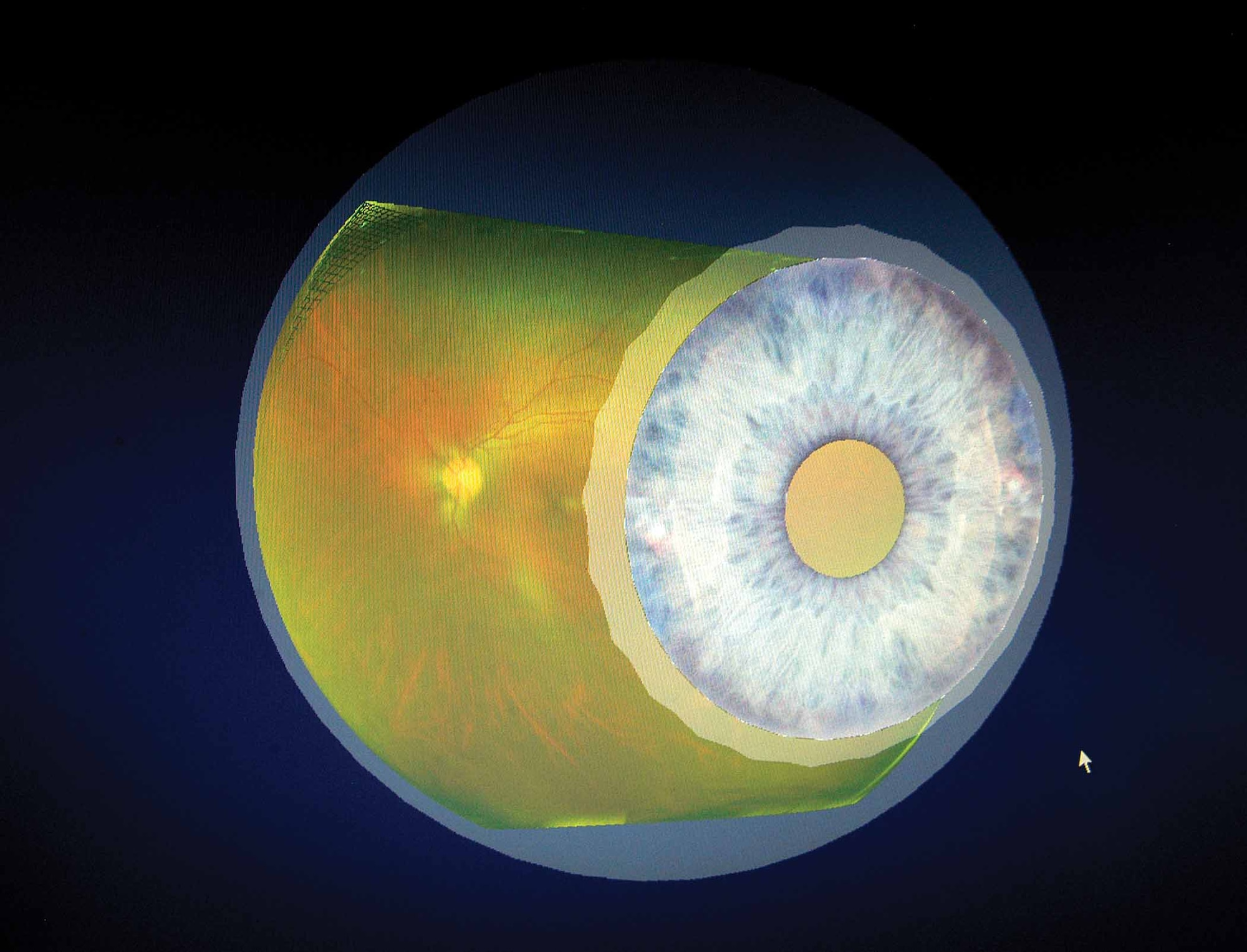 Optometry Clinic patients can watch the retinal mapping of their eye as the image slowly rotates, giving a 200-degree view immediately after scanning with the new ophthalmoscope.  (Air Force photos by Margo Wright)

