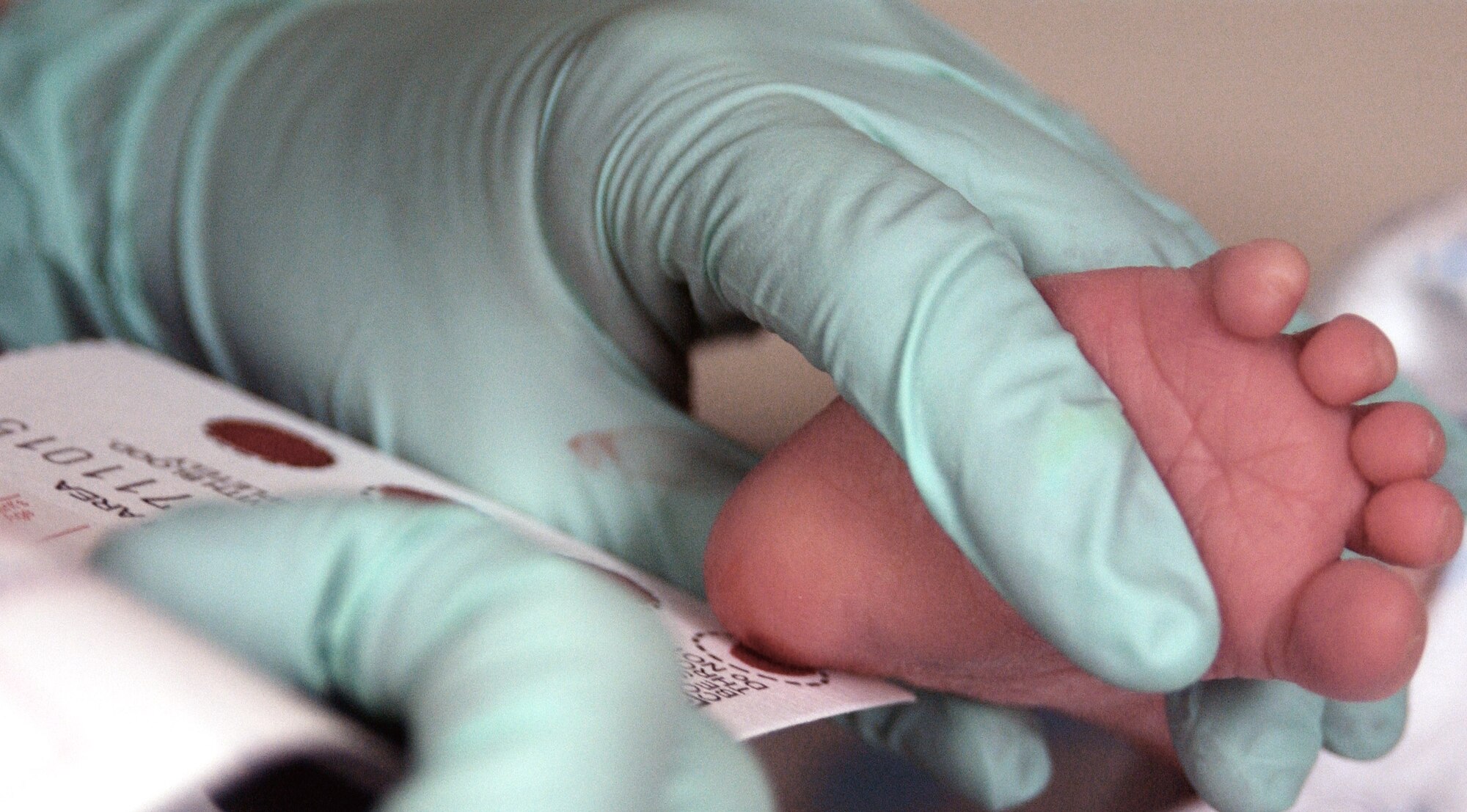 The blood of a two week-old infant is collected for a Phenylketonuria, or PKU, screening Dec. 12 at Eielson Air Force Base, Alaska. PKU is a recessive genetic disorder that can cause problems with brain development, which could lead to mental retardation and seizures. All infants born at Eielson AFB are screened for PKU at their two-week, well baby check up appointment. (U.S. Air Force photo/Staff Sgt Eric T. Sheler)