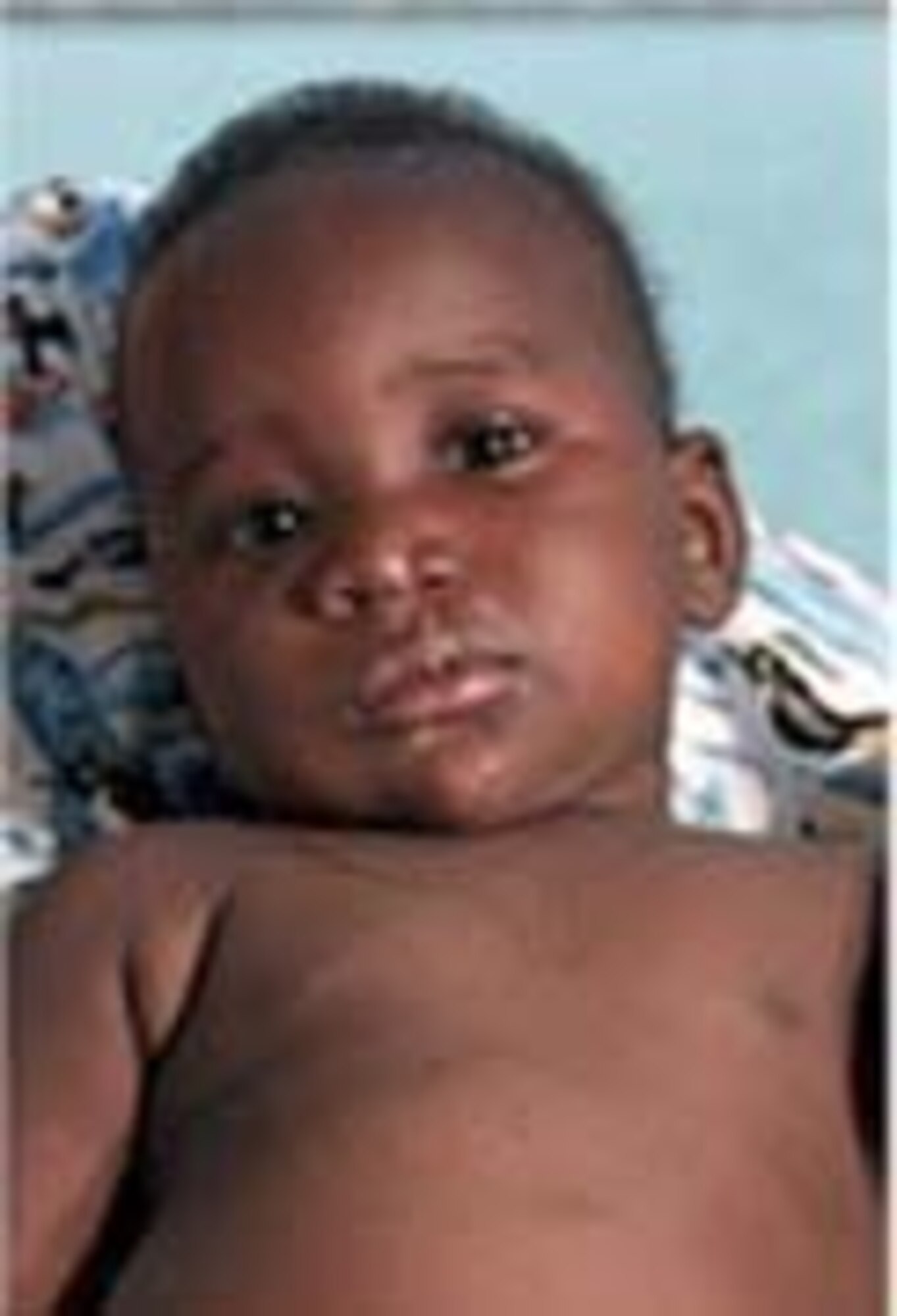 PORT OF TEMA, GHANA -- After gaining more than 10 pounds following close medical care, Mamadou was finally able to undergo surgery to repair his cleft lip and palate. (Courtesy photos)
