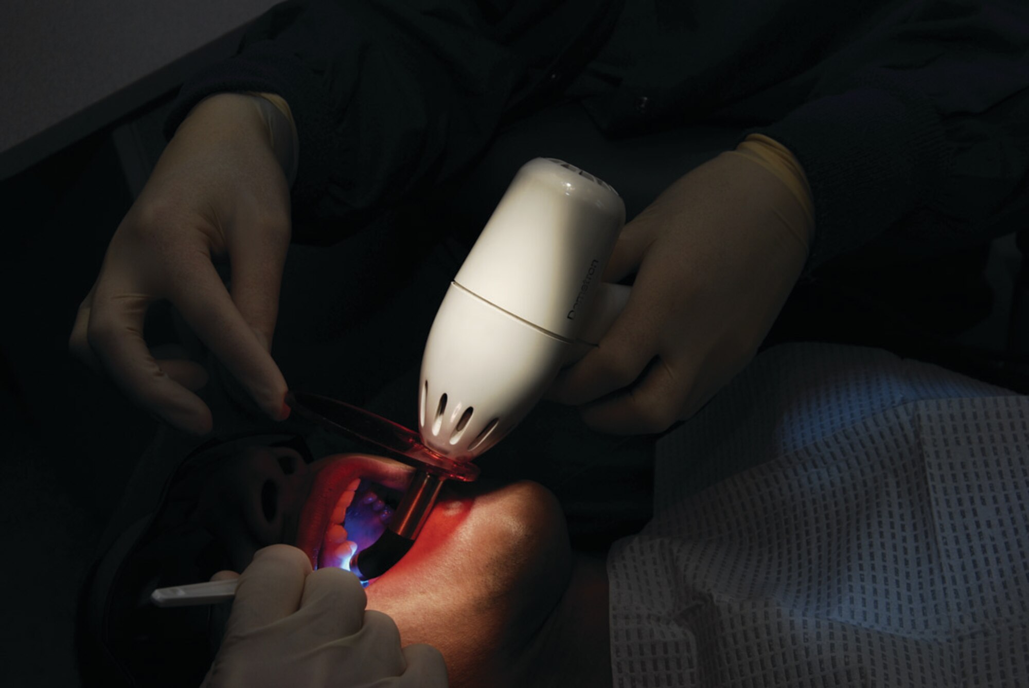 SPANGDAHLEM AIR BASE, GERMANY -- A member of the 52nd Dental Squadron uses an ultraviolet curing light for performing fillings on patients. The 52nd DS celebrated National Dental Assistant Recognition Week March 5-9. The squadron officers provided prizes, certificates and an award luncheon to the entire staff. The events were designed to recognize the multitalented and versatile dental assistants and support personnel who facilitate and enhance the delivery of quality dental health care to the members of 52nd Fighter Wing. (US Air Force photo/Nick Anderson)
