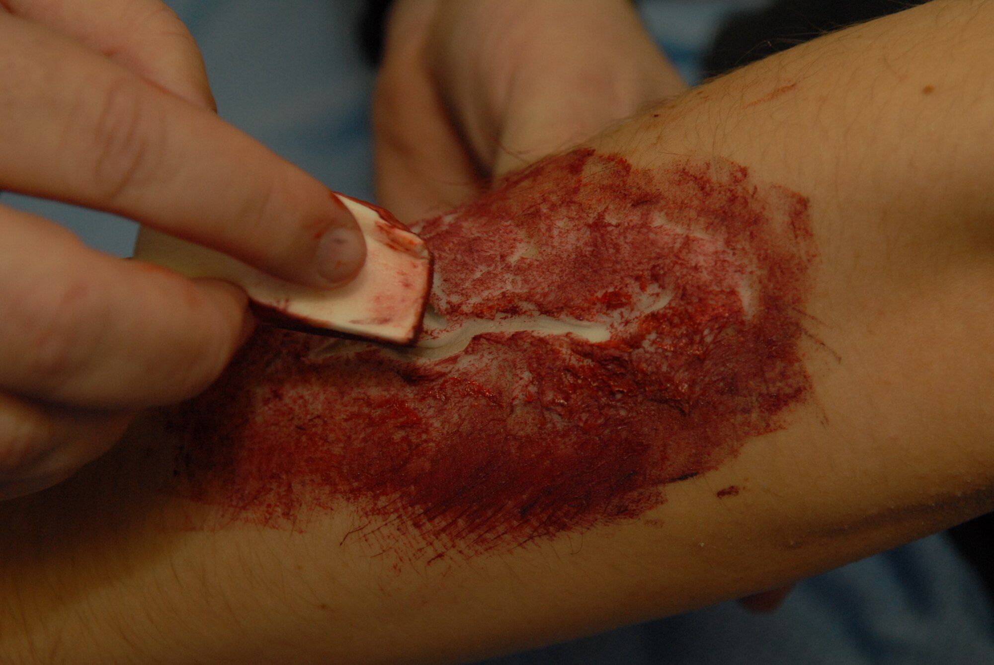 Extreme close up of a faked wound on the arm of Airman 1st Class Ryan Yeckering in preparation for the natural disaster exercise on Goodfellow Air Force Base March 13. (U.S. Air Force photo by Tech. Sgt. Randy Mallard)
