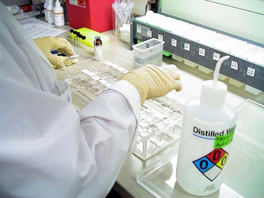 Roswita Moxley, a biological lab technician at the U.S. Army Medical Research Institute of