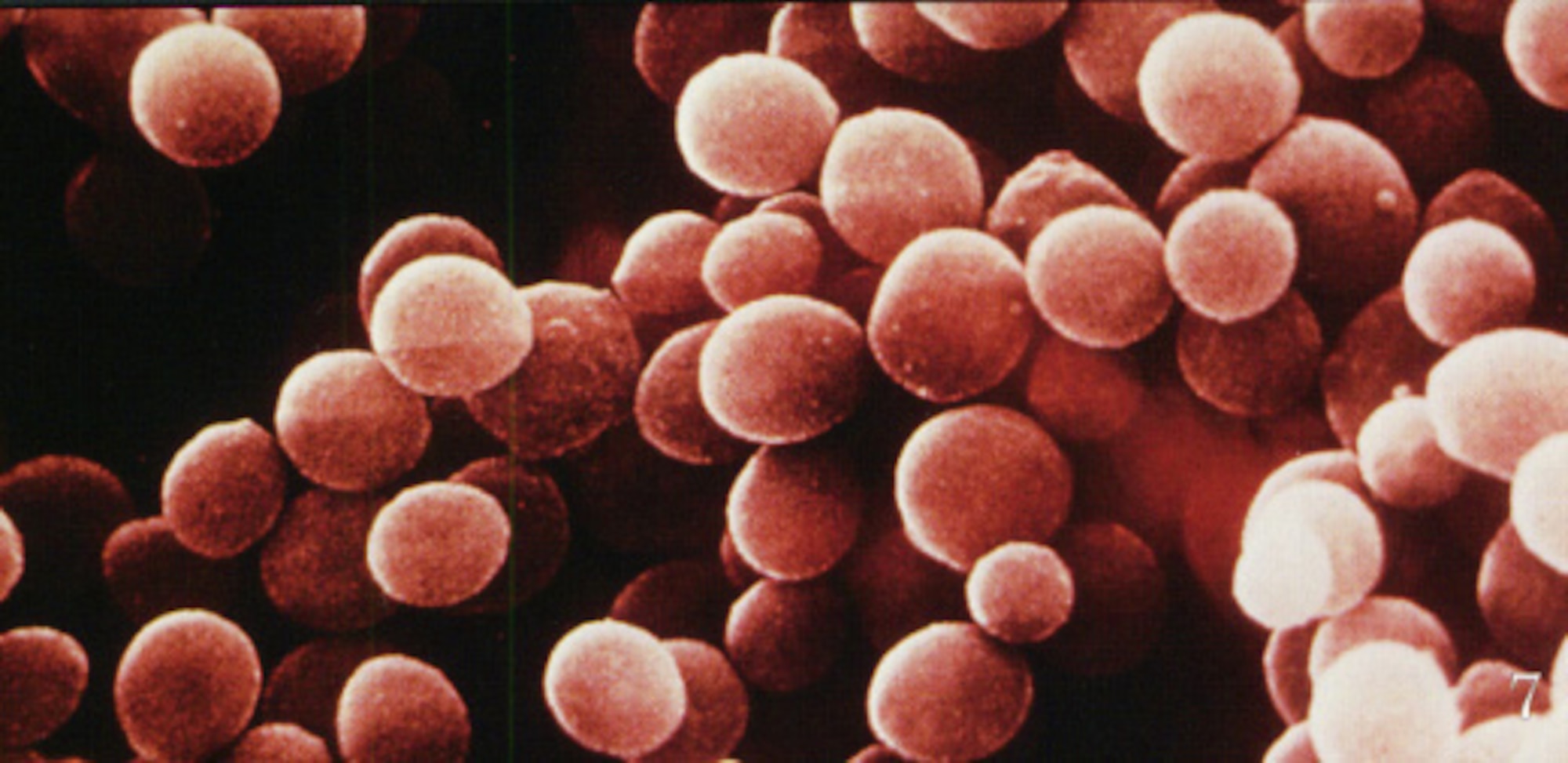 Electron micrograph of Staphylococcus aureus. (Copyright David Phillips/Visuals Unlimited)