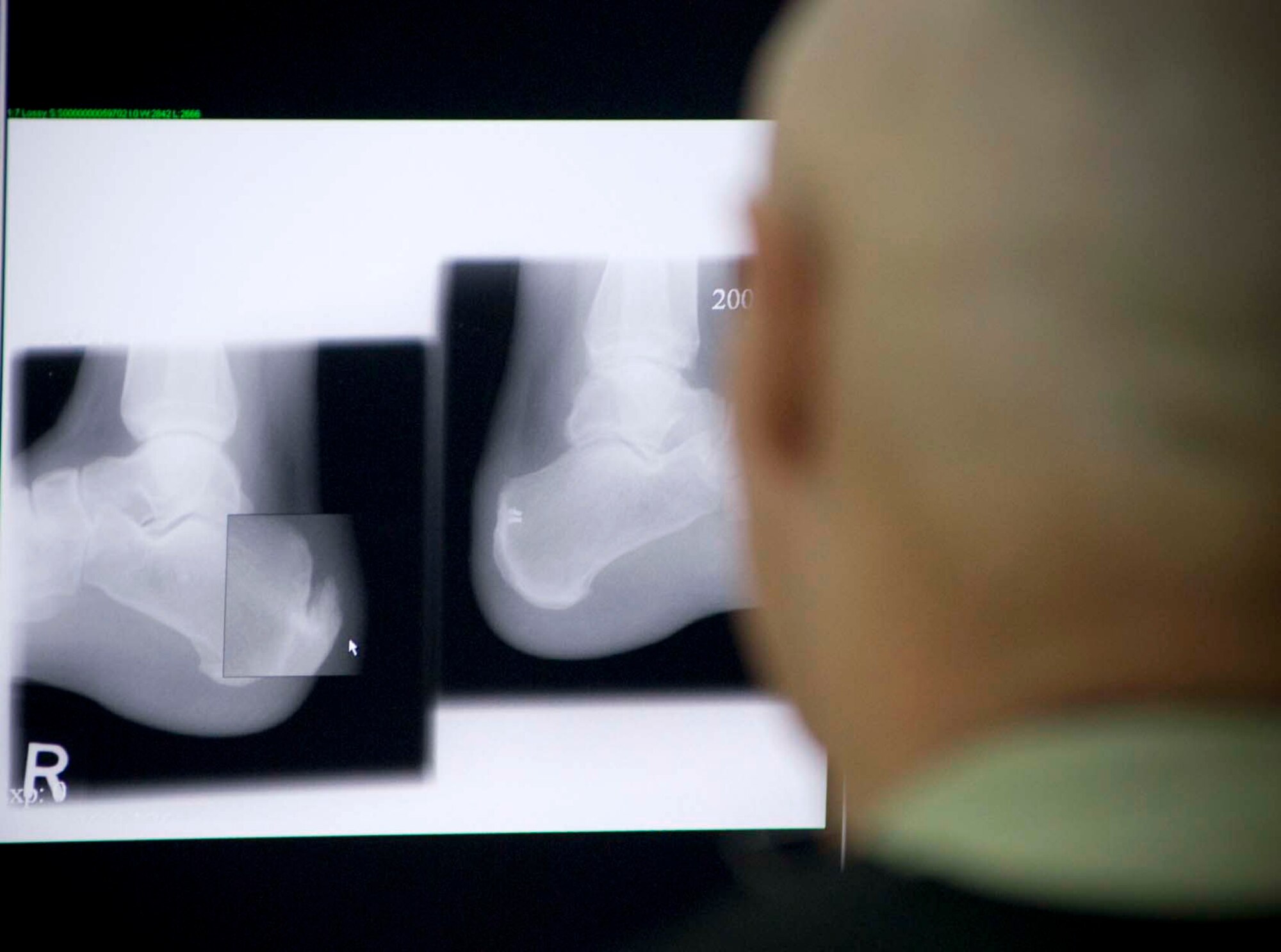 Lt. Col. Gary Sherwood reviews x-rays Oct. 4 at the Air Force Theater Hospital at Balad Air Base, Iraq. Colonel Sherwood is the officer in charge at the 332nd Expeditionary Medical Support Squadron Physical Therapy/Occupational Therapy Clinic. (U.S. Air Force photo/Master Sgt. John Nimmo) 