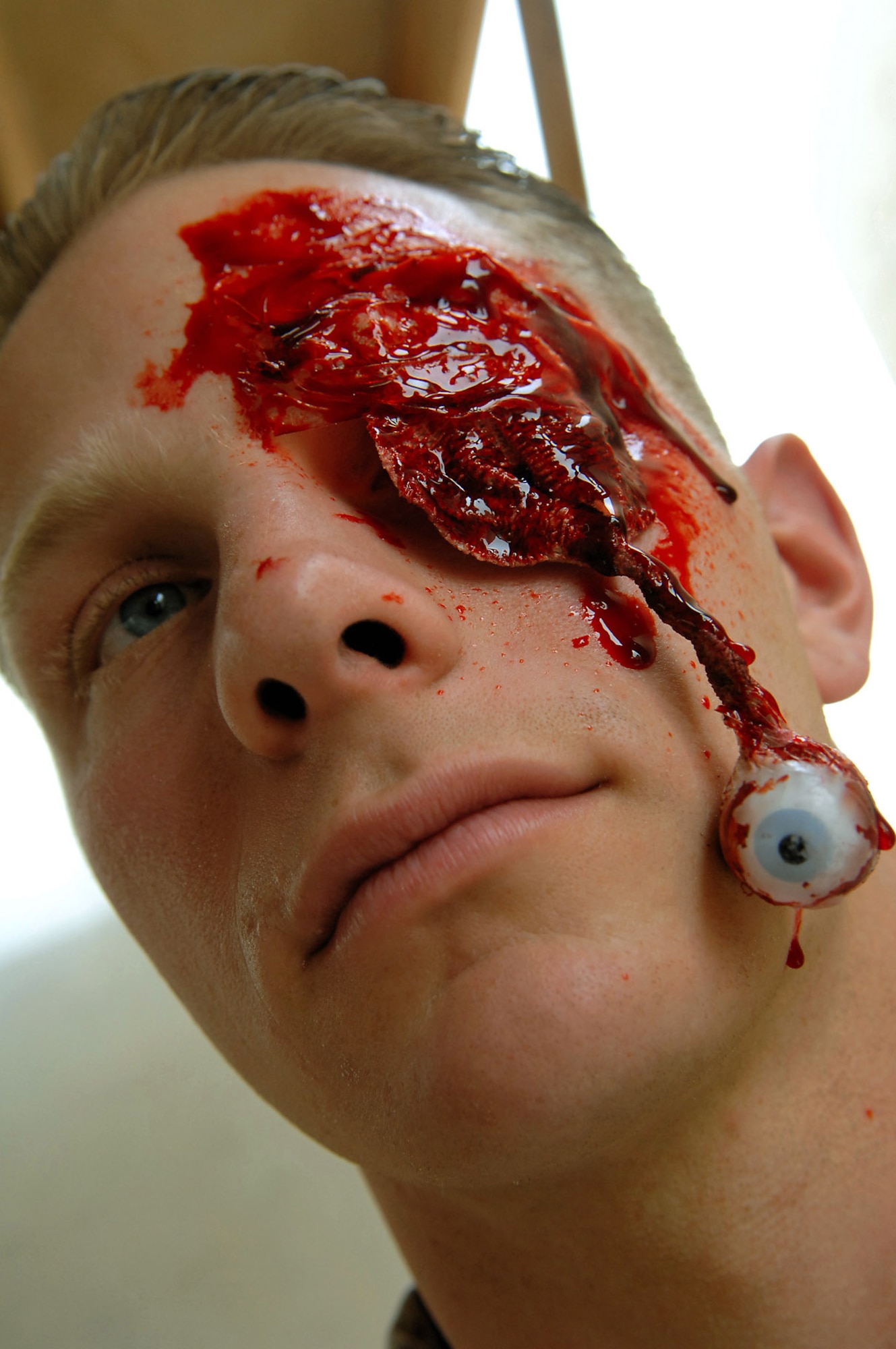 Army Sgt. Joshua Martin wears moulage to simulate an eye injury March 31 at Balad Air Base, Iraq. Nearly 50 servicemembers were moulaged at Jamison Medical Training Center with injuries ranging from small burns to extensive head wounds and even lost limbs in order to add an element of realism to a mass casualty battle drill. Sergeant Martin is a 403rd Inland Cargo Transition Company cargo specialist deployed from Fort Bragg, N.C. (U.S. Air Force photo/Senior Airman Senior Airman Julianne Showalter) 
