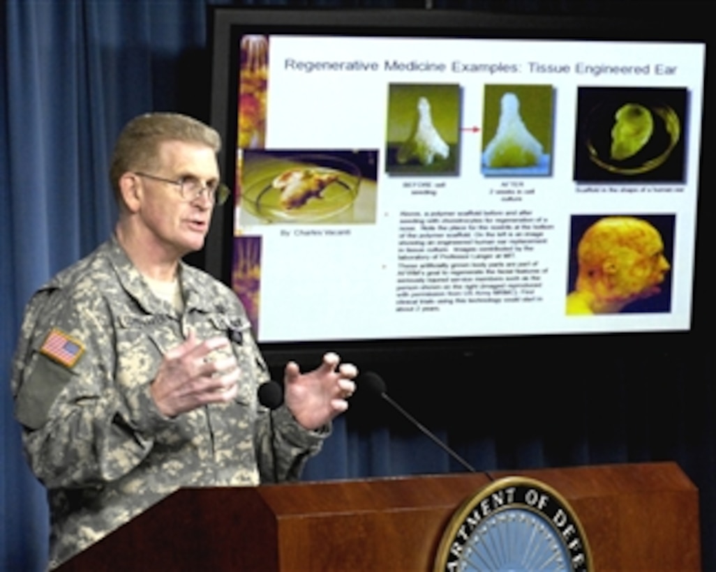 U.S. Army Surgeon General Lt. Gen. Eric Schoomaker explains, during an April 17, 2008 Pentagon press conference, how researchers are growing a new ear for a badly burned Marine using stem cells from his own body. This is one area of advanced treatment being explored by the new Armed Forces Institute of Regenerative Medicine.  