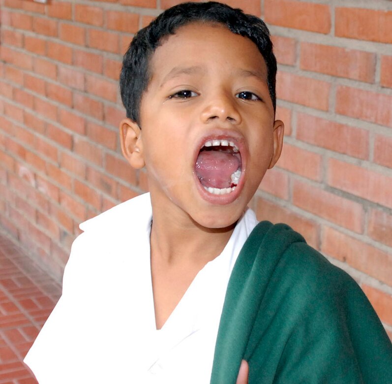 SOTO CANO AIR BASE, Honduras -- A Honduran boy shows off his dental work while after being seen during a dental readiness training exercises (DETRETE) at Catholic University?s dental school in Tegucigalpa April 18. The children, ranging in ages from five years old to 10 years old, are mostly students from two of the poorer schools in Tegucigalpa; Escuela Mon Senior Fiallos and Escuella Lempira. (U.S. Air Force photo by Tech. Sgt. William Farrow)