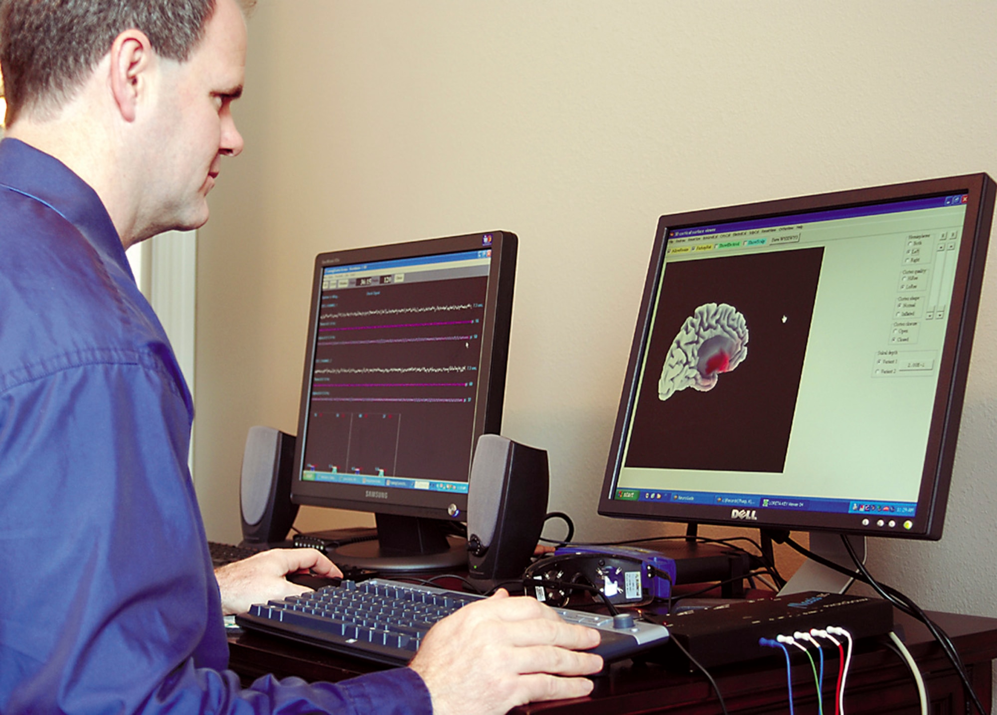 Dr. David Tharp is one of a growing number of mental health professionals who think neurofeedback could provide significant relief to many men and women suffering from post-traumatic stress disorder. (Bo Joyner)