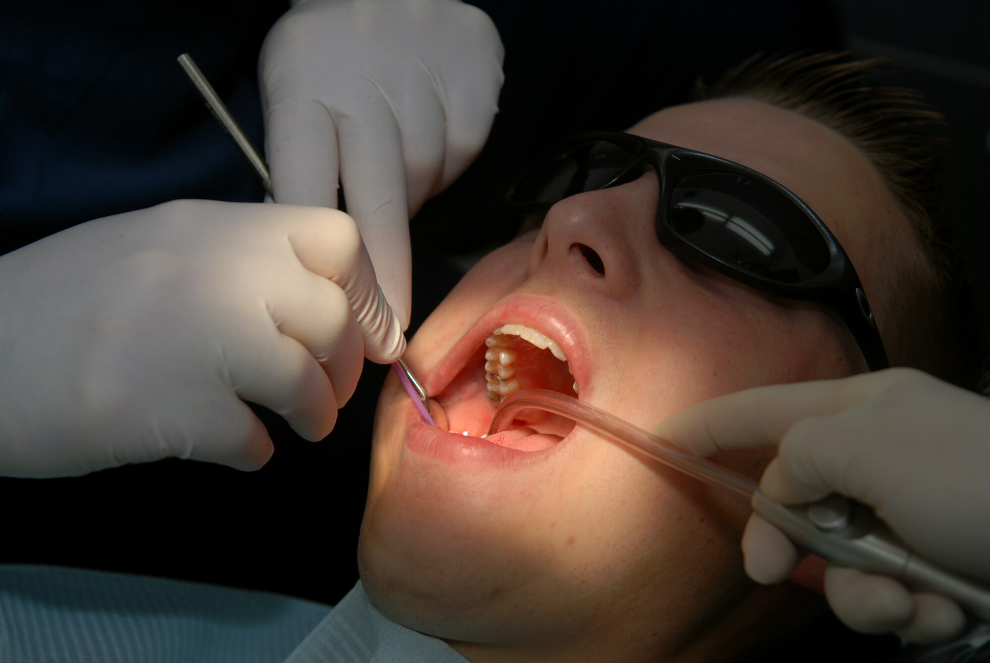 Doctor (Capt.) Michael Savidan cleans the teeth of Staff Sgt. Daniel Patrick at the dental clinic here. (U.S. Air Force photo/Airman 1st Class Antoinette Lyons) 