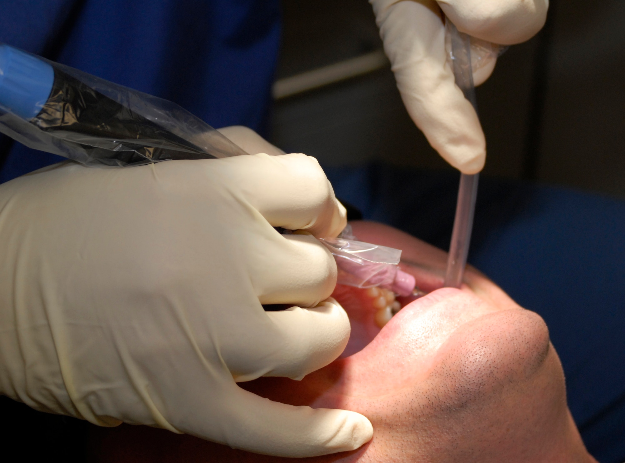 KUNSAN AIR BASE, Republic of Korea --Senior Airman Charles Powell, a dental technician with the 8th Medical Operations Squadron, uses an ultrasonic scaler to clean a patient's teeth here Aug. 14. (U.S. Air Force photo by Senior Airman Dana Hill)