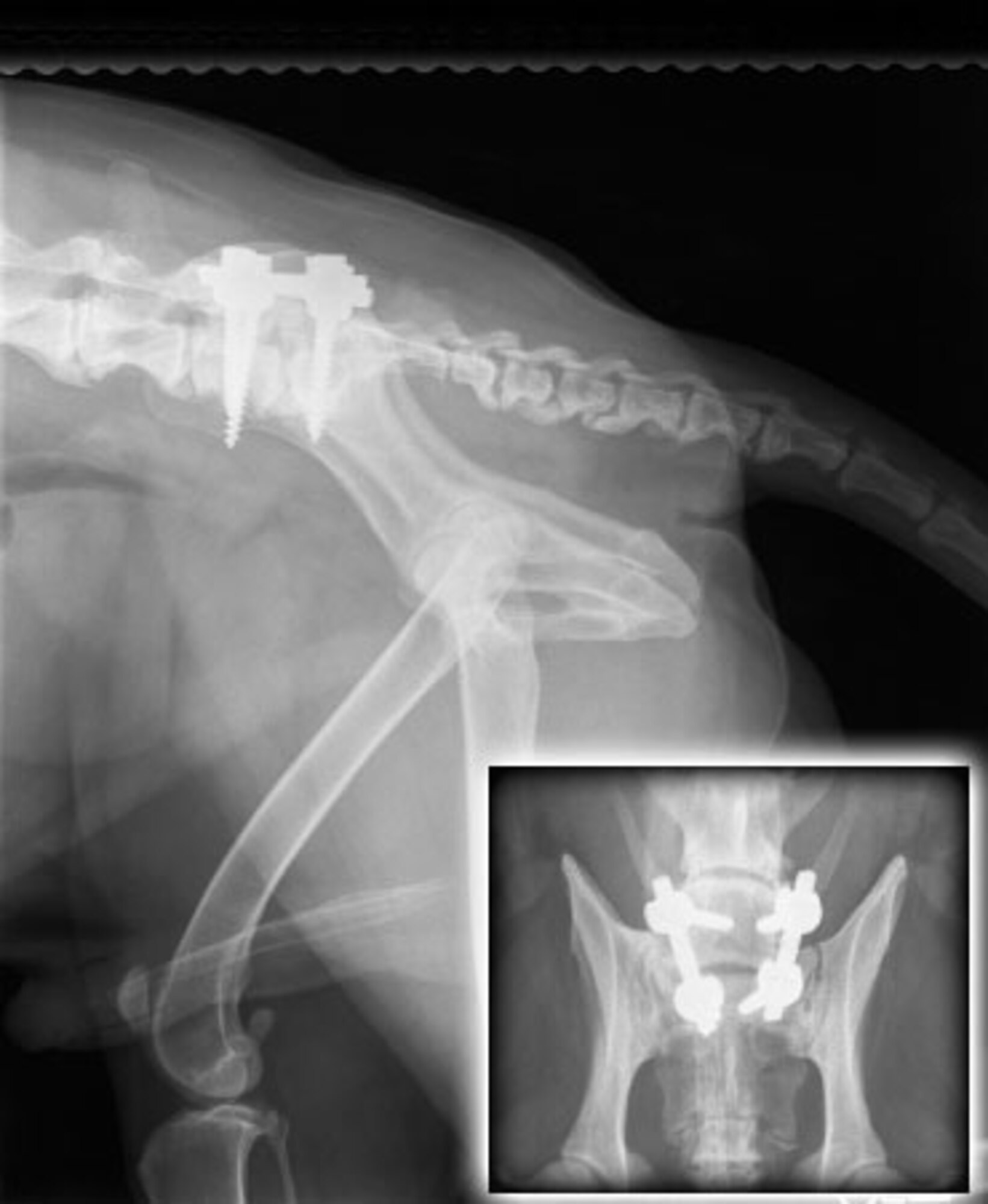 These X-rays show where the two pins and four screws were placed in Jampy's pelvic bones to stabilize his lower back. (Courtesy photo)