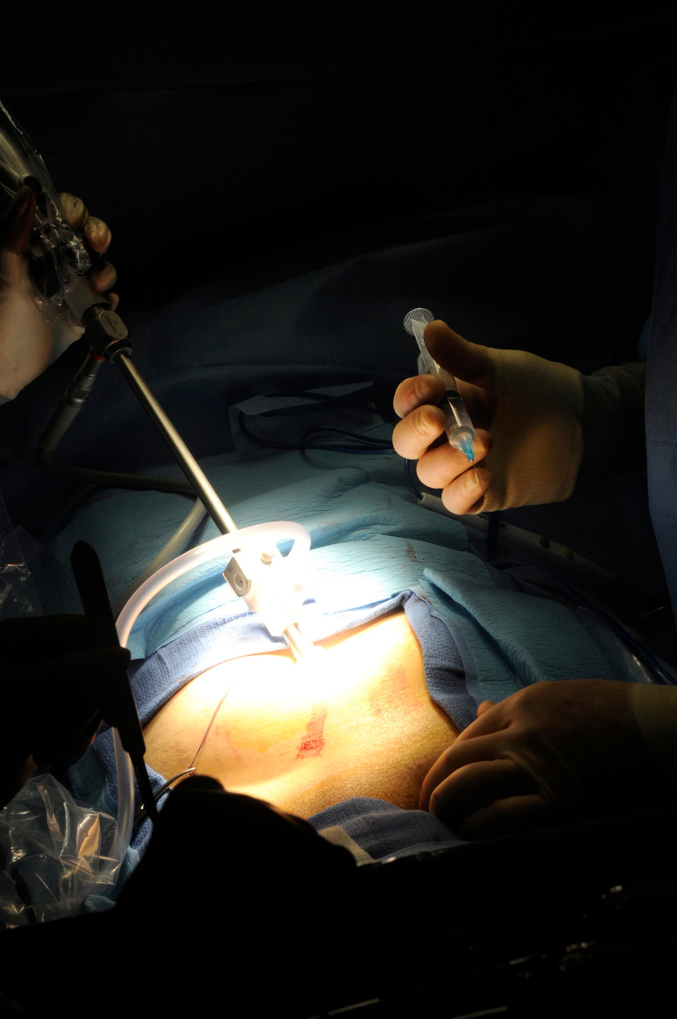 Senior Airman Brittney Hardrick, surgical technician, places a camera inside of a patient so Maj. Craig Kolasch, general surgeon, can perform a laparoscopic hernia repair Dec. 23, 2008, at an undisclosed air base in Southwest Asia. Both Airmen are assigned to the 379th Expeditionary Medical Group. Many of the surgeries performed here are hernia repairs. Airman Hardrick is a native of Dayton Ohio, and Major Kolasch, is a native of Great Falls, Va. Both are deployed from Keesler Air Force Base, Miss., in support of Operations Iraqi and Enduring Freedom and Joint Task Force-Horn of Africa. (U.S. Air Force photo by Staff Sgt. Darnell T. Cannady/Released)