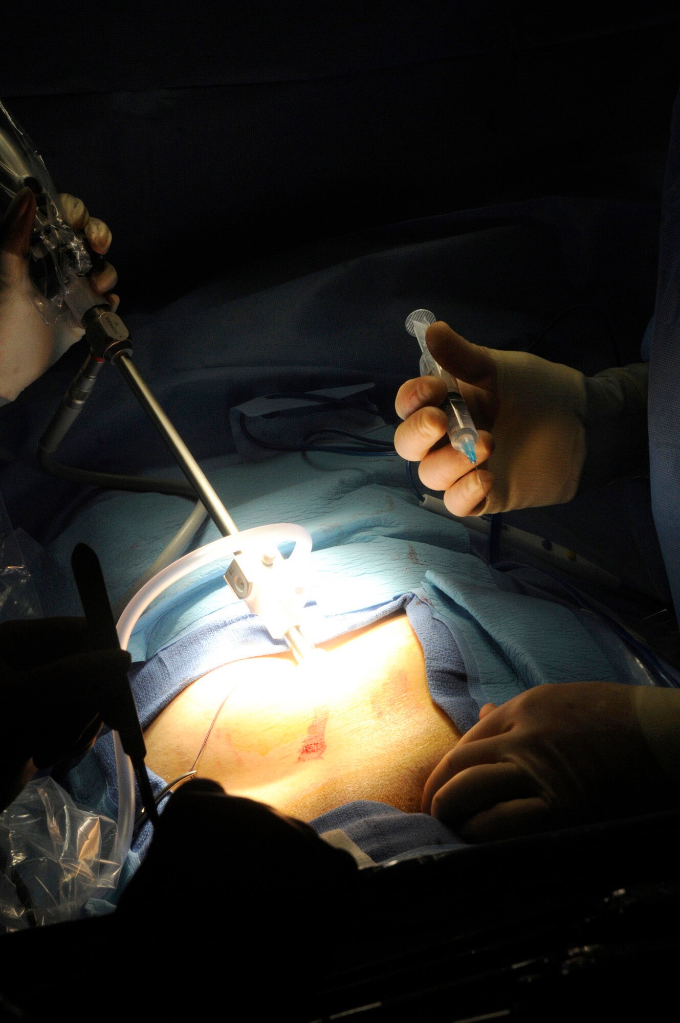 Senior Airman Brittney Hardrick places a camera inside a patient so Dr. (Maj.) Craig Kolasch, general surgeon, can perform a laparoscopic hernia repair Dec. 23 at an undisclosed air base in Southwest Asia. Airman Hardrick is a surgical technician. Both Airmen are assigned to the 379th Expeditionary Medical Group. Many of the surgeries performed here are hernia repairs. Airman Hardrick is a native of Dayton Ohio, and Major Kolasch, is a native of Great Falls, Va. Both are deployed from Keesler Air Force Base, Miss., in support of Operations Iraqi and Enduring Freedom and Joint Task Force-Horn of Africa. (U.S. Air Force photo/Staff Sgt. Darnell T. Cannady)