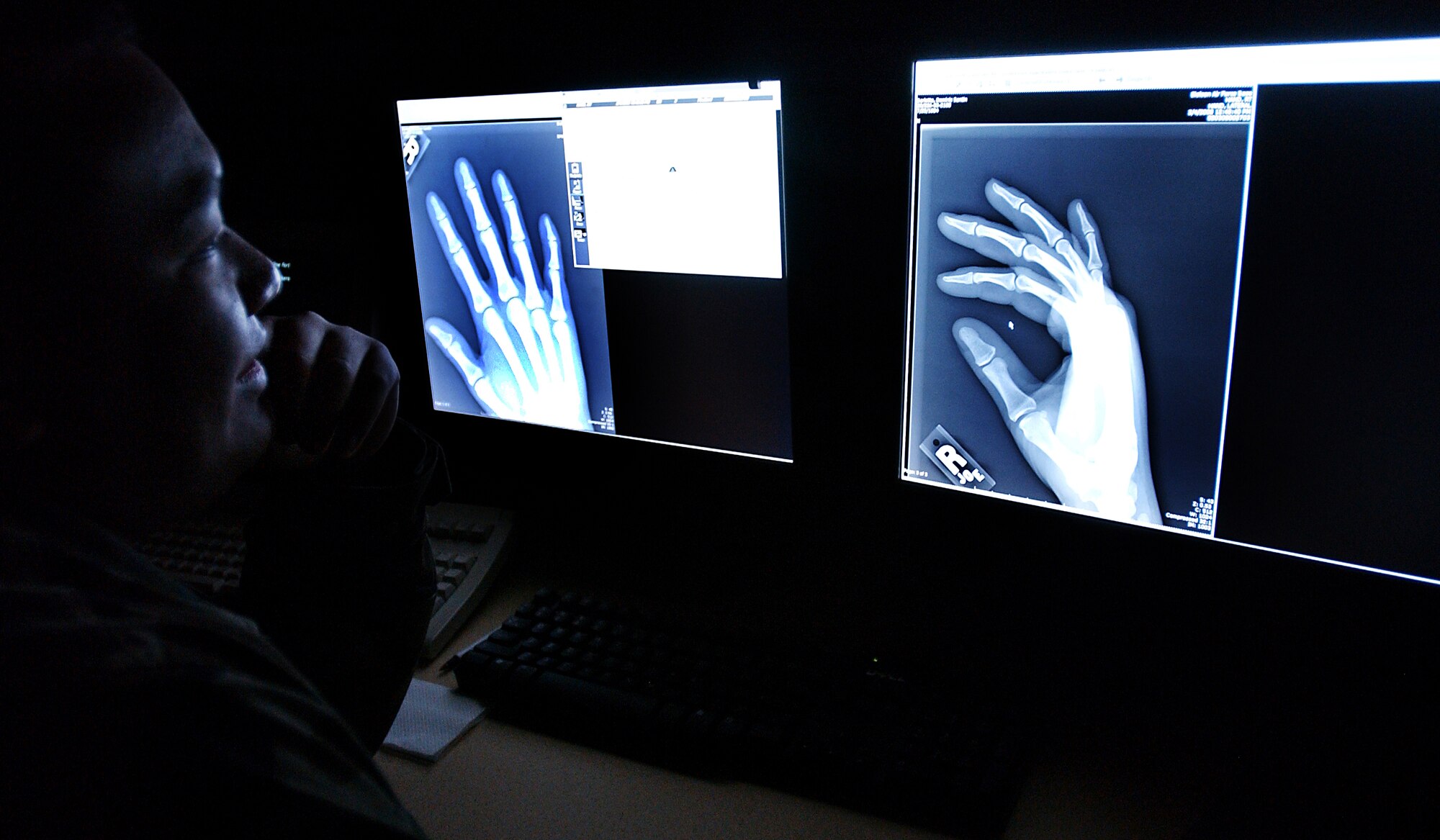 U.S Air Force Staff Sgt. Rutherford Alejo, a Diagnostic Imaging Technician assigned to the 354th Medical Group, Eielson Air Force Base, Alaska views and analyzes a processed radiograph of a hand for quality control before sending the images to the physician who requested the x-ray. Each processed radiograph is checked for correct exposure, proper position, and other items to ensure the radiograph is free from any defects and the area being examined is clear based on position and exposure so the physician can make a precise diagnosis.

(U.S Air Force photo by: Staff Sgt Eric T. Sheler)