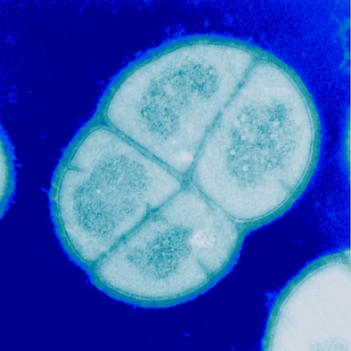 This image shows a cross-section of four cells of the bacteria, Deinococcus radiodurans, which is used in radiation resistance studies. (Photo courtesy of Dr. Michael Daly)