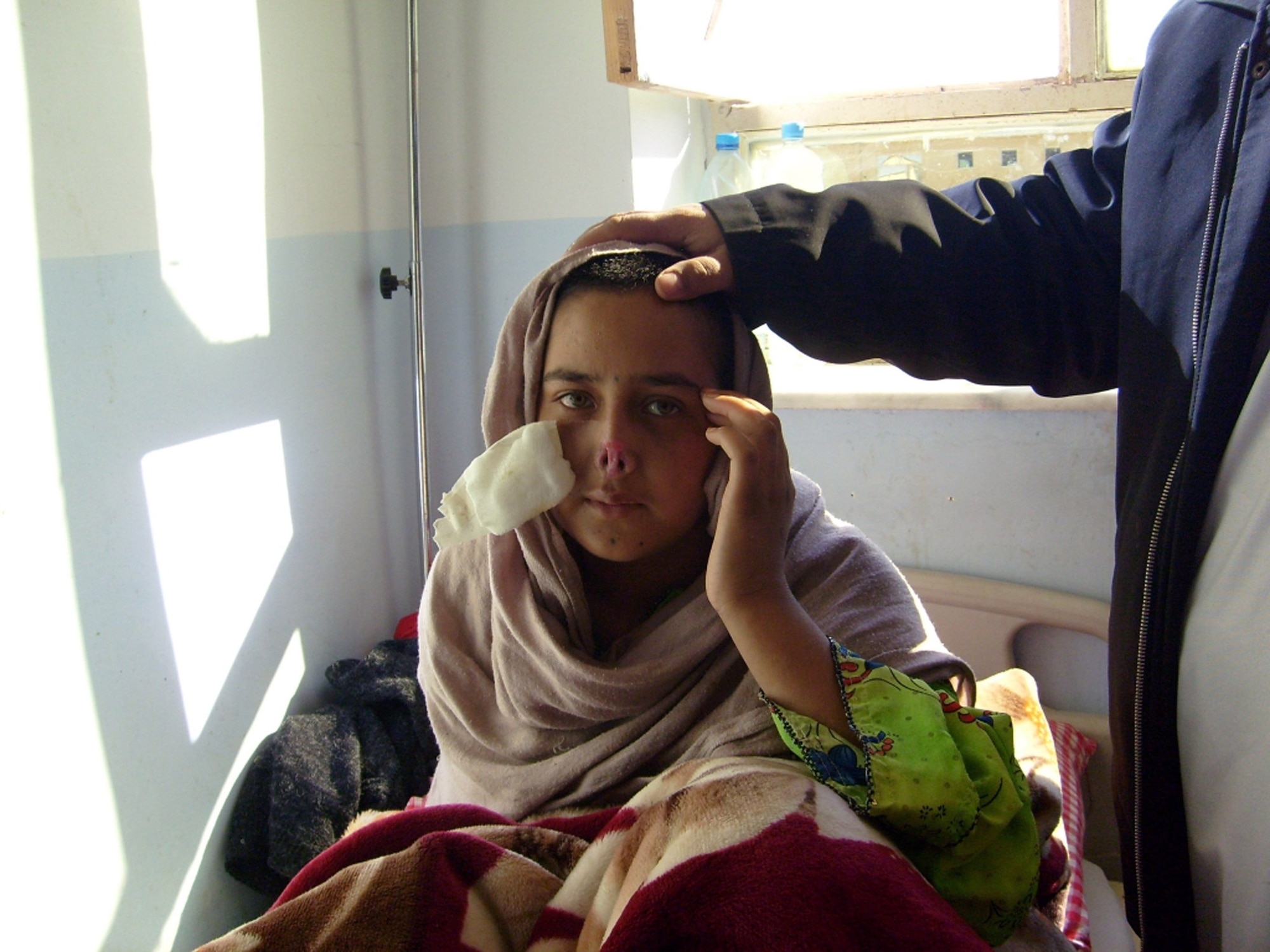 Nazia Hookum Darr, 16 years old, was brutally attacked here by her 40-year-old husband of three months on Christmas day. The man, who is still on the run from police, broke 16 of his wife's teeth, shaved her head, cut off her nose and ears and poured scalding water on her hands and feet. The young woman is set to receive plastic surgery in Kabul following close coordination between the Afghan government and Provincial Reconstruction Team Qalat, a joint U.S. Air Force and Army unit there. (Air Force photo/Lt. Col. Michael Gauron) 