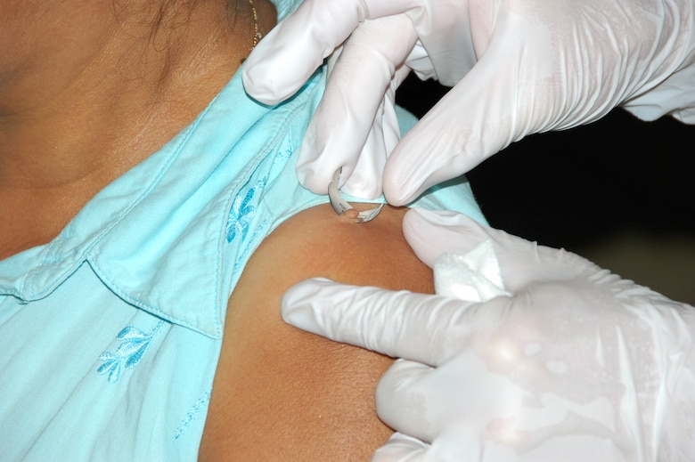 Lt. Col. Steven E. Ritter removes a skin tag from a patient with a razor blade at a school in Cabuya, Panama during Medical Readiness Training Exercise-Panama July 15. Colonel Ritter is a dermatologist from the 81st Medical Operations Squadron at Keesler Air Force Base, Miss. (U.S. Air Force photo/Capt. Ben Sakrisson)