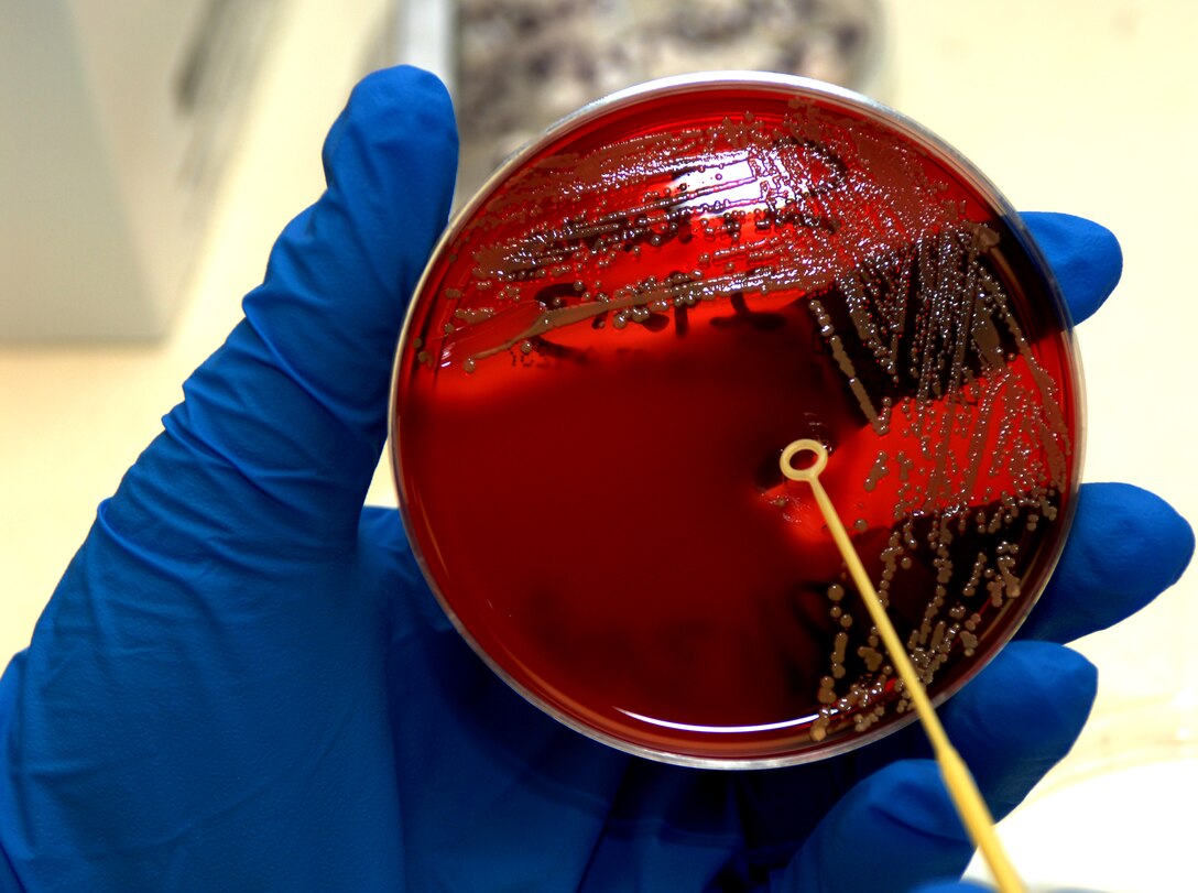 LANGLEY AIR FORCE BASE, Va. -- Airman 1st Class Ashley Lemley, a lab technician at the 1st Fighter Wing Hospital, holds up a blood agar plate covered with the bacteria staphylococcus aureus July 16. Lab technicians perform tests and cultures on specimens and process the results for doctors.  (U.S. Air Force photo/Airman 1st Class Sylvia Olson)