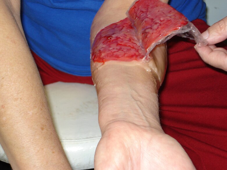A moulage wound is applied to a volunteer's forearm. (U.S. Air Force courtesy photo)