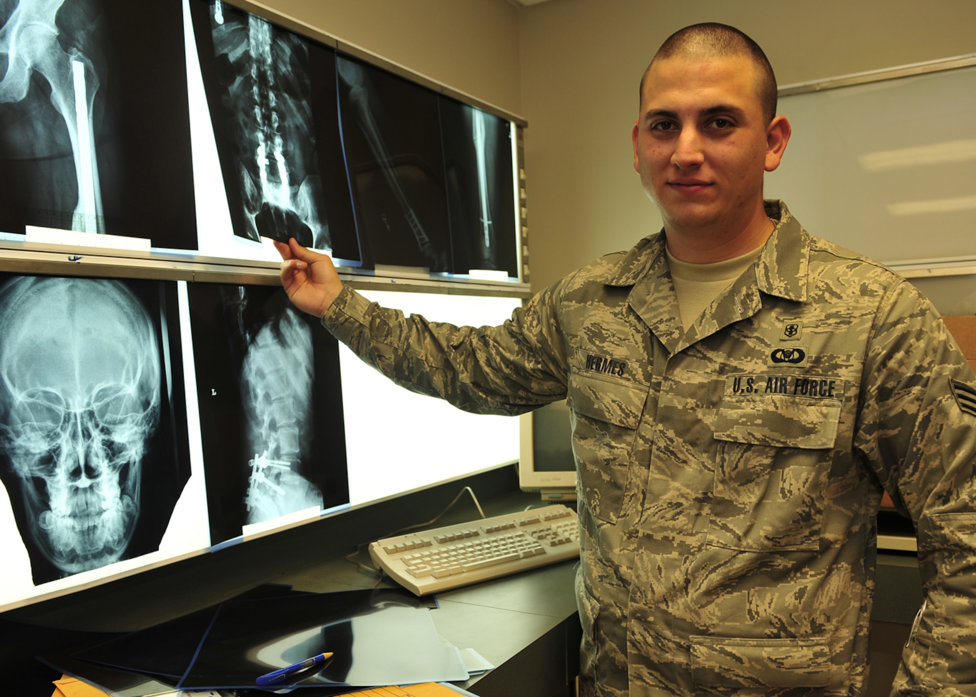 MOODY AIR FORCE BASE, Ga. -- Senior Airman Brian Hermes, 23rd Medical Group radiology tech, places an X-ray film onto a lighting board to be examined here June 12. Airman Hermes was selected to participate in a nuclear medicine program at the Nuclear Medicine Technologist School, Naval School of Health Sciences in Portsmouth, Va. (U.S. Air Force photo by Senior Airman Elizabeth Rissmiller)