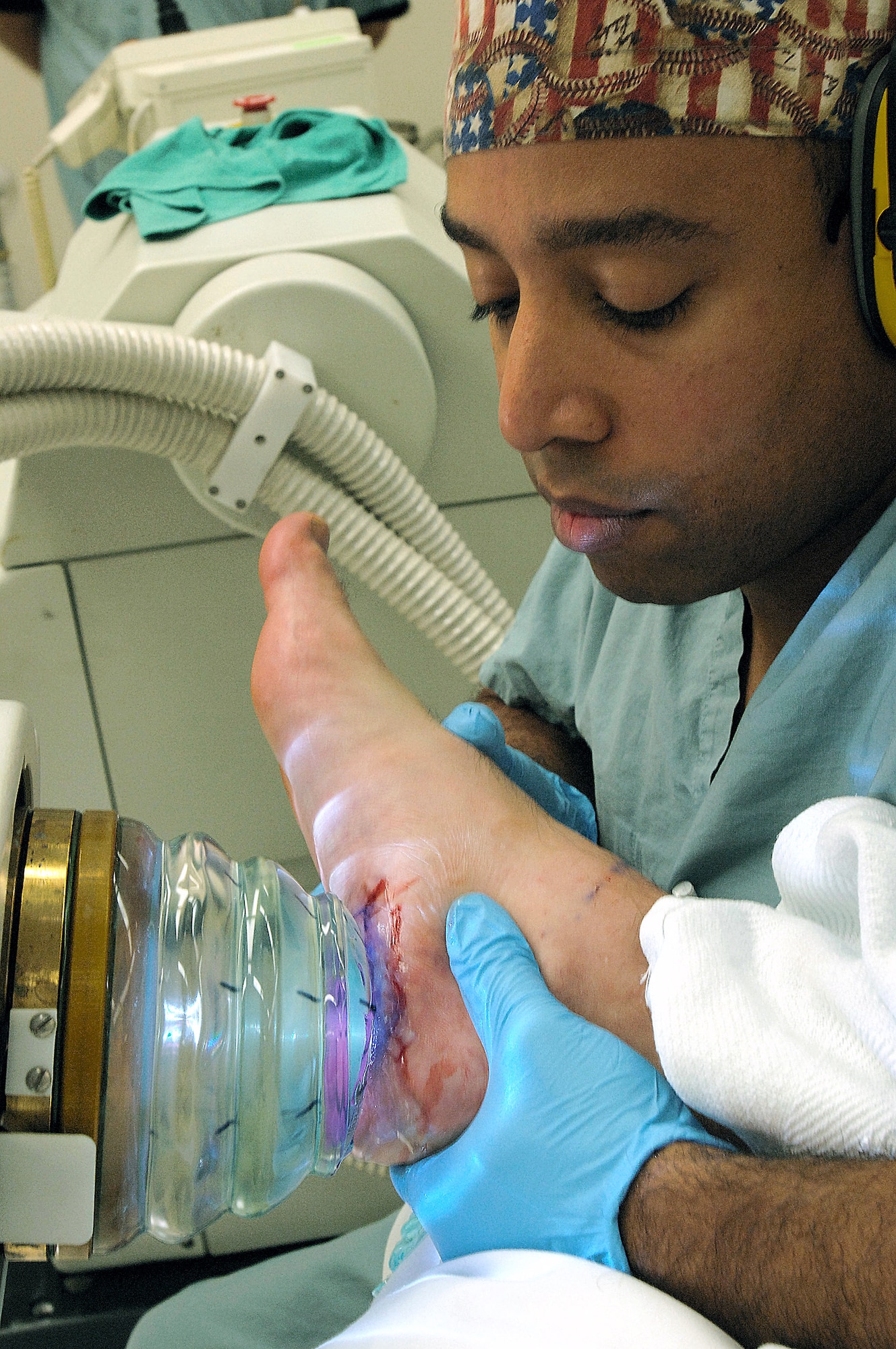 Capt. Hjalmar Contreras, 59th Orthopedic and Rehabilitation Squadron, performs an Ossatron procedure March 14 on a patient at Wilford Hall Medical Centerat Lackland Air Force Base, Texas.  Captain Contreras is the chief of podiatric surgery and spearheaded a new procedure to treat severe plantar fasciitis that requires less recovery time for patients. (U.S. Air Force photo/Senior Airman Erin M. Peterson)