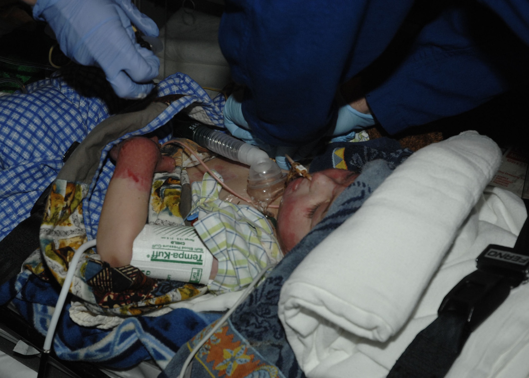 Three-year-old, Al-Amreeki**, was the victim of a stove fire Jan. 25 in his family’s home in the Salah ah Din province.  The fire left him with second and third degree burns covering 45 percent of his body, along with inhalation burns to his lungs.  Due to the severity of his burns, Iraqi doctors quickly determined his best chance for survival was with the U.S. Air Force Theater Hospital located at Balad Air Base, Iraq, where the boy has been under constant medical care since Jan. 25. He arrived at Cincinnati Lunken Field Airport late Friday night, March 21 and was transported by ambulance to the burn unit at The Shriner’s Hospital for Children, Cincinnati for treatment. (Air Force photos by Al Bright)

**Names have been changed to protect the child and his family.

