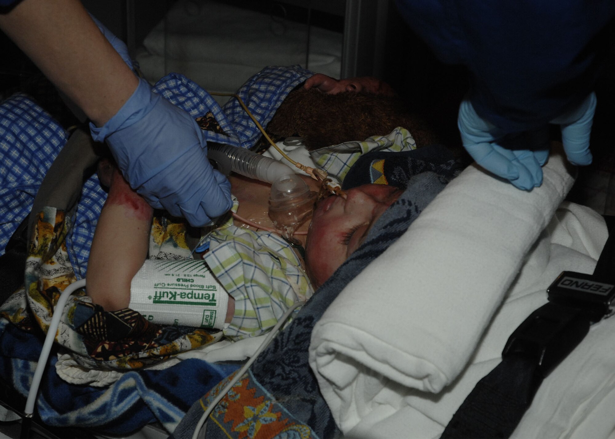 Three-year-old, Al-Amreeki**, was the victim of a stove fire Jan. 25 in his family’s home in the Salah ah Din province.  The fire left him with second and third degree burns covering 45 percent of his body, along with inhalation burns to his lungs.  Due to the severity of his burns, Iraqi doctors quickly determined his best chance for survival was with the U.S. Air Force Theater Hospital located at Balad Air Base, Iraq, where the boy has been under constant medical care since Jan. 25. He arrived at Cincinnati Lunken Field Airport late Friday night, March 21 and was transported by ambulance to the burn unit at The Shriner’s Hospital for Children, Cincinnati for treatment. (Air Force photos by Al Bright)

**Names have been changed to protect the child and his family.

