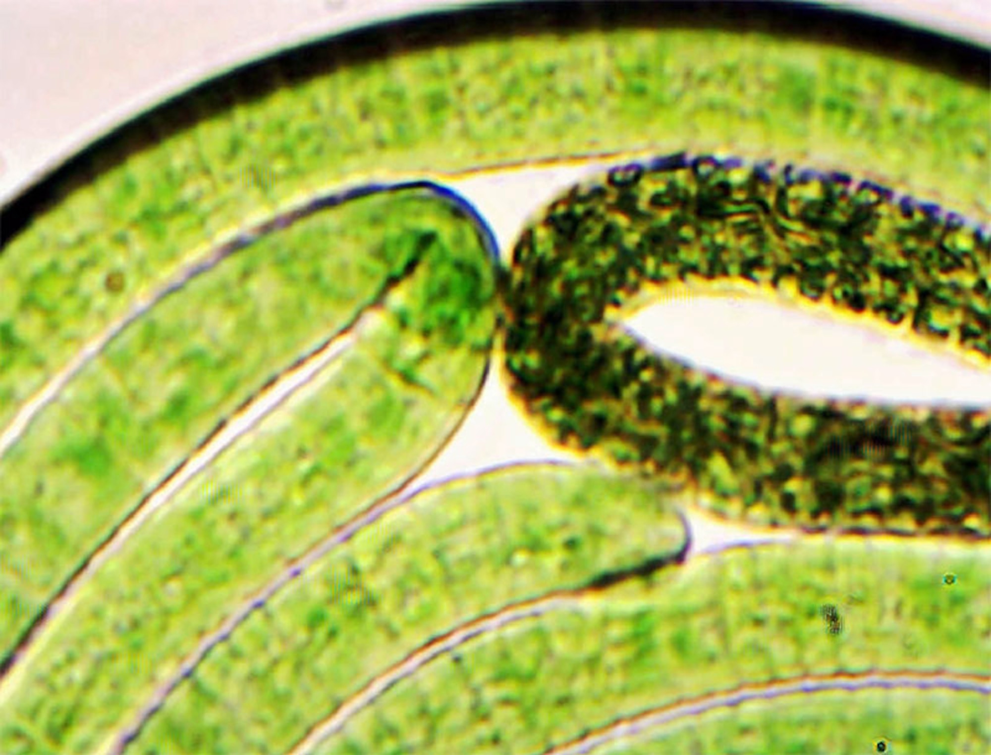 A picture of Arthrospira maxima, a cyanobacteria