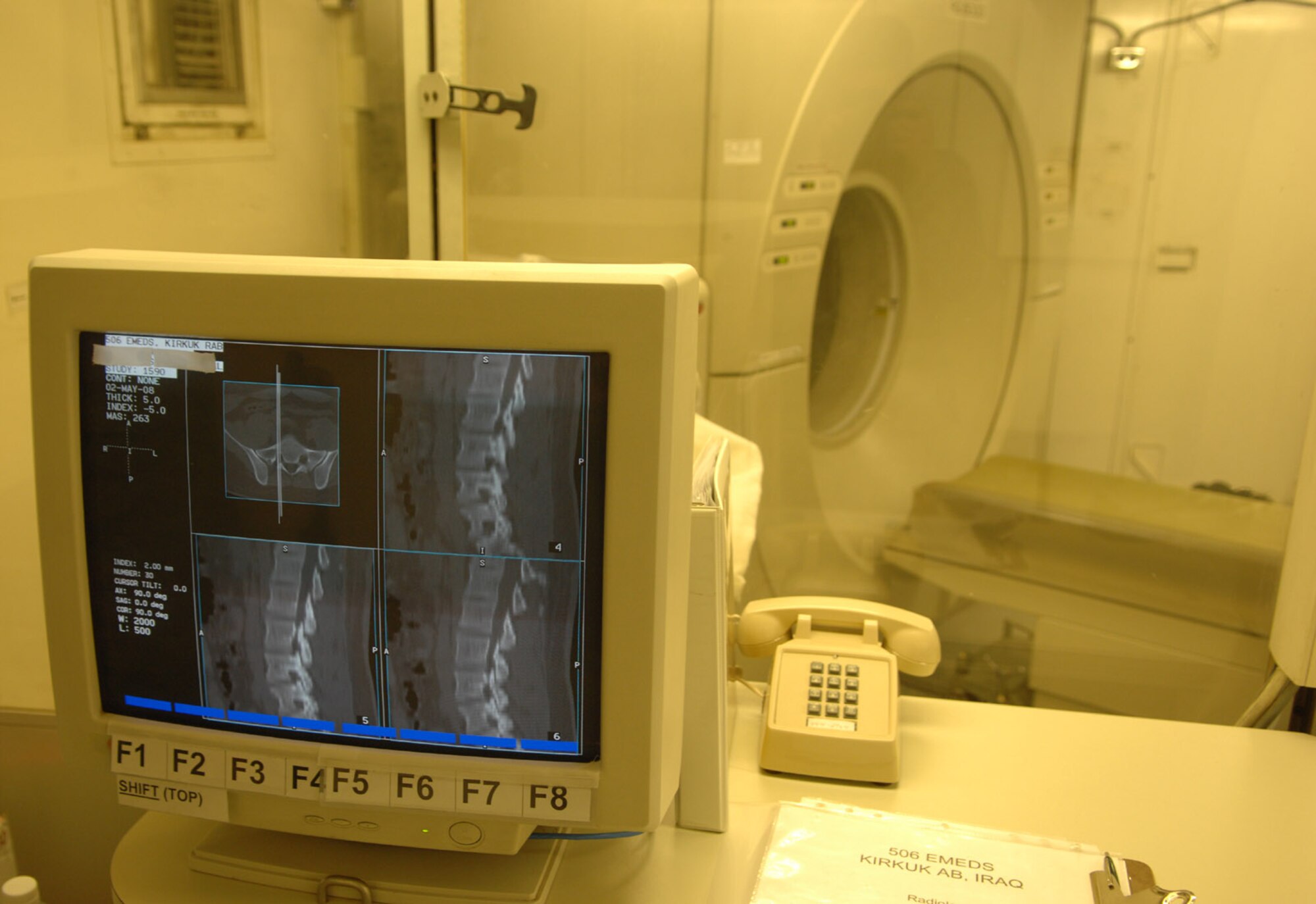 The 506th Expeditionary Medical Squadron expanded its medical capabilities with the recent acquisition of a computed tomography scanner. Known as a CT scanner, the machine takes X-ray images of the body's internal areas in multi-plane slices - an improvement from typical X-ray techniques. (U.S. Air Force photo by Senior Airman Eric Schloeffel)