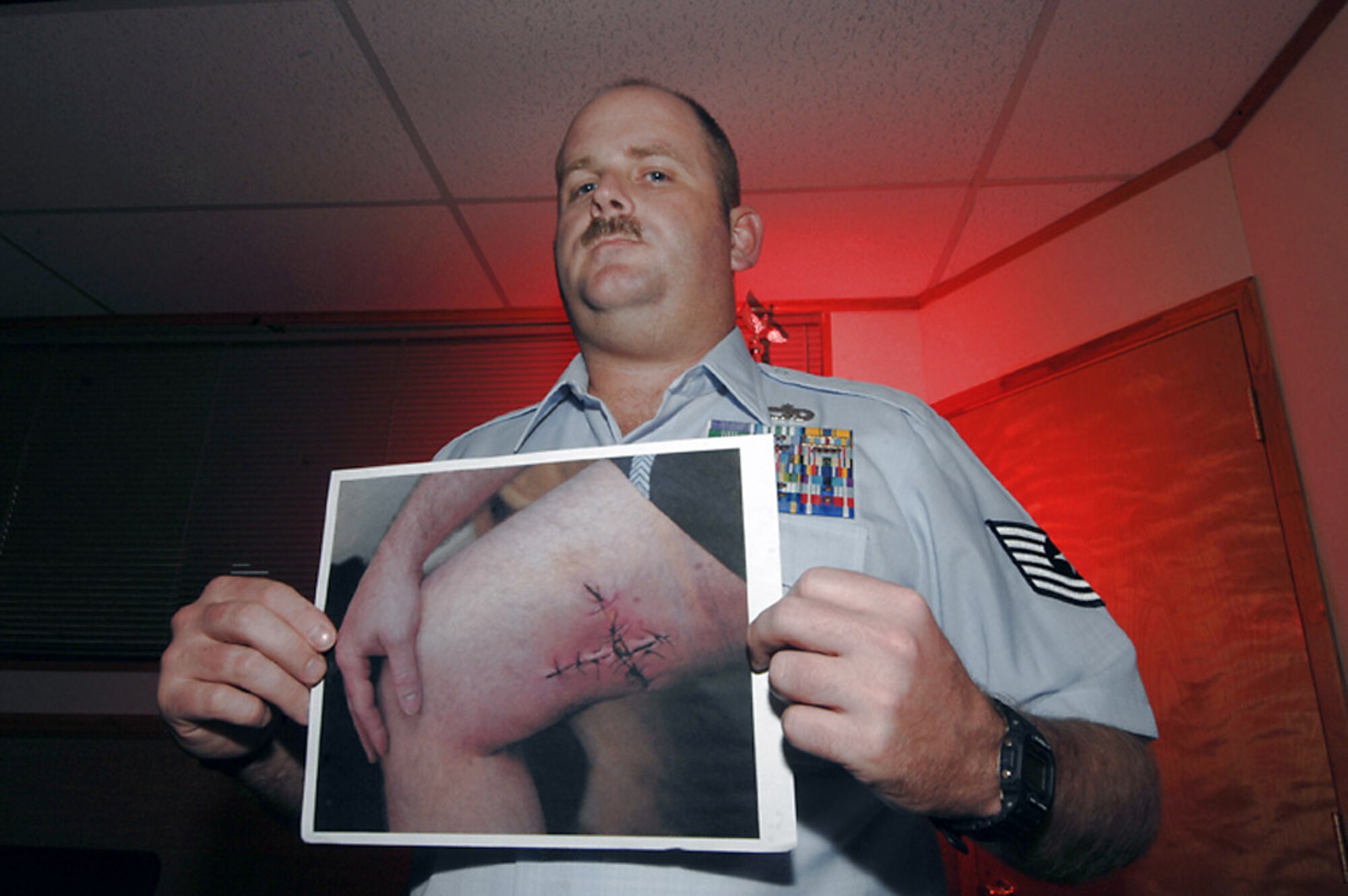 Tech. Sgt. Jerome Baker shows a photo taken after his first surgery in Baghdad, Iraq. He is the 56th Logistics Readiness training NCO at Luke Air Force Base, Ariz. (U.S. Air Force photo/Tech. Sgt. Jeffrey A. Wolfe) 