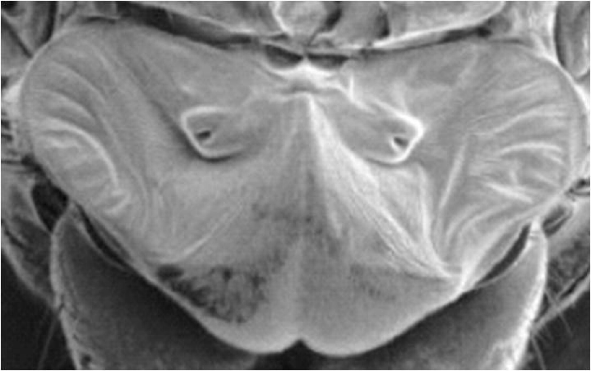 A professor of Mechanical Engineering at the University of Maryland is researching miniature acoustic sensors and sound localization techniques using the hearing mechanisms of flies as a model. This image depicts a fly ear. (Credit: Dr. Miao Yu, University of Maryland.)