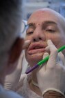 Dr. Timothy Miller, chief of reconstructive and plastic surgery at the University of California Los Angeles Medical Center, marked Aaron Mankin's face during an examination before Mankin's 12th surgery under Miller's knife Nov. 18 at UCLA Medical Center. Mankin was the first wounded service member to take advantage of Operation Mend, a partnership between the U.S. military and UCLA Medical Center, through which UCLA provides world-class plastic reconstructive surgeries to disfigured service members. (Official U.S. Marine Corps photo by Staff Sgt. Ethan E. Rocke)