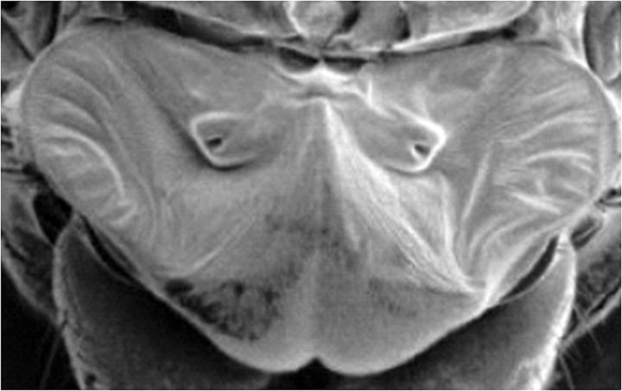 This image depicts a fly's ear, which is being used as a model for research at the University of Maryland for miniature acoustic sensors and sound localization techniques. (Courtesy image/Dr. Miao Yu) 



