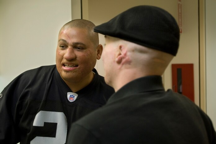 Octavio Sanchez and Aaron Mankin, both wounded service members who were given new noses by UCLA's world-class plastic reconstructive surgeons, take a moment to catch up at UCLA Medical Center Nov. 24. Mankin and Sanchez are both medically retired Marines who have had multiple surgeries through Operation Mend, a partnership between the U.S. military and UCLA Medical Center, through which UCLA provides world-class plastic reconstructive surgeries to disfigured service members. (Official U.S. Marine Corps photo by Staff Sgt. Ethan E. Rocke)