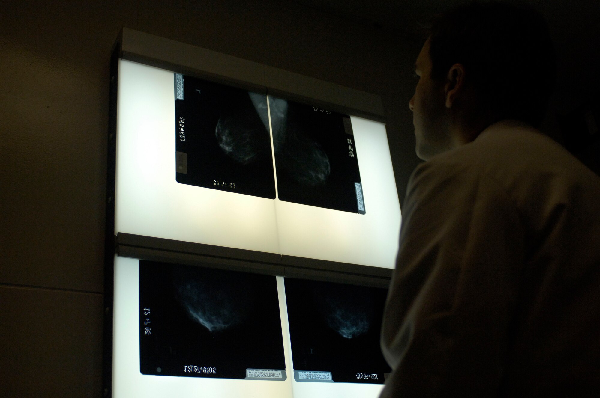 LANGLEY AIR FORCE BASE, Va. -- Maj. Jason Morvant, chief of surgery at the 1st Fighter Wing Hospital, examines mammogram films.  Annual mammograms are key in helping doctors detect and diagnose breast cancer in patients.  Both annual mammograms and monthly self-breast examinations play important roles in prevention and early detection of the disease. (U.S. Air Force photo/Airman 1st Class Sylvia Olson)