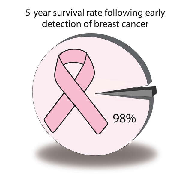 Breast cancer survial rate chart. (Courtesy graphic)